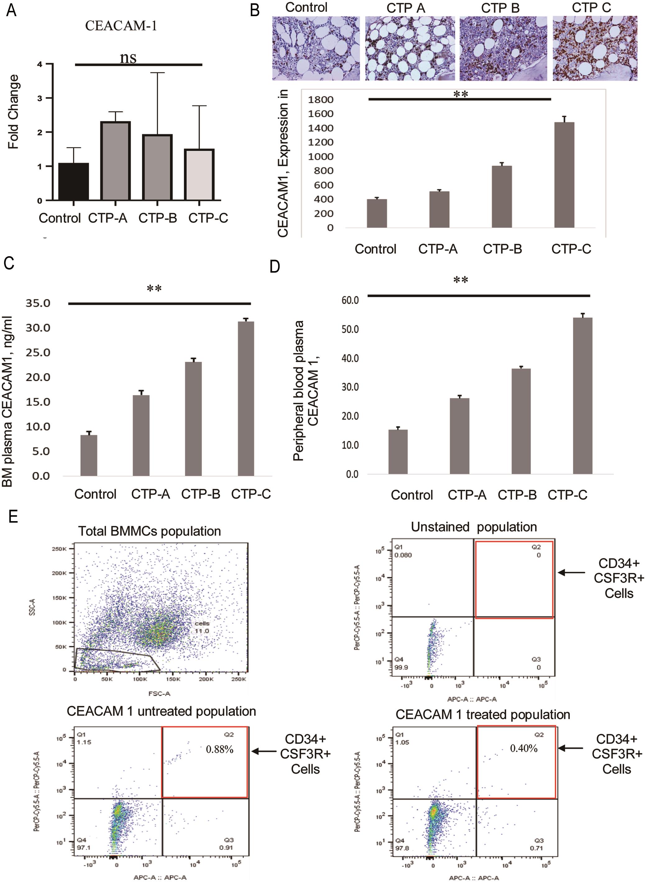 CEACAM-1 in cirrhosis and its association with CSF3R.