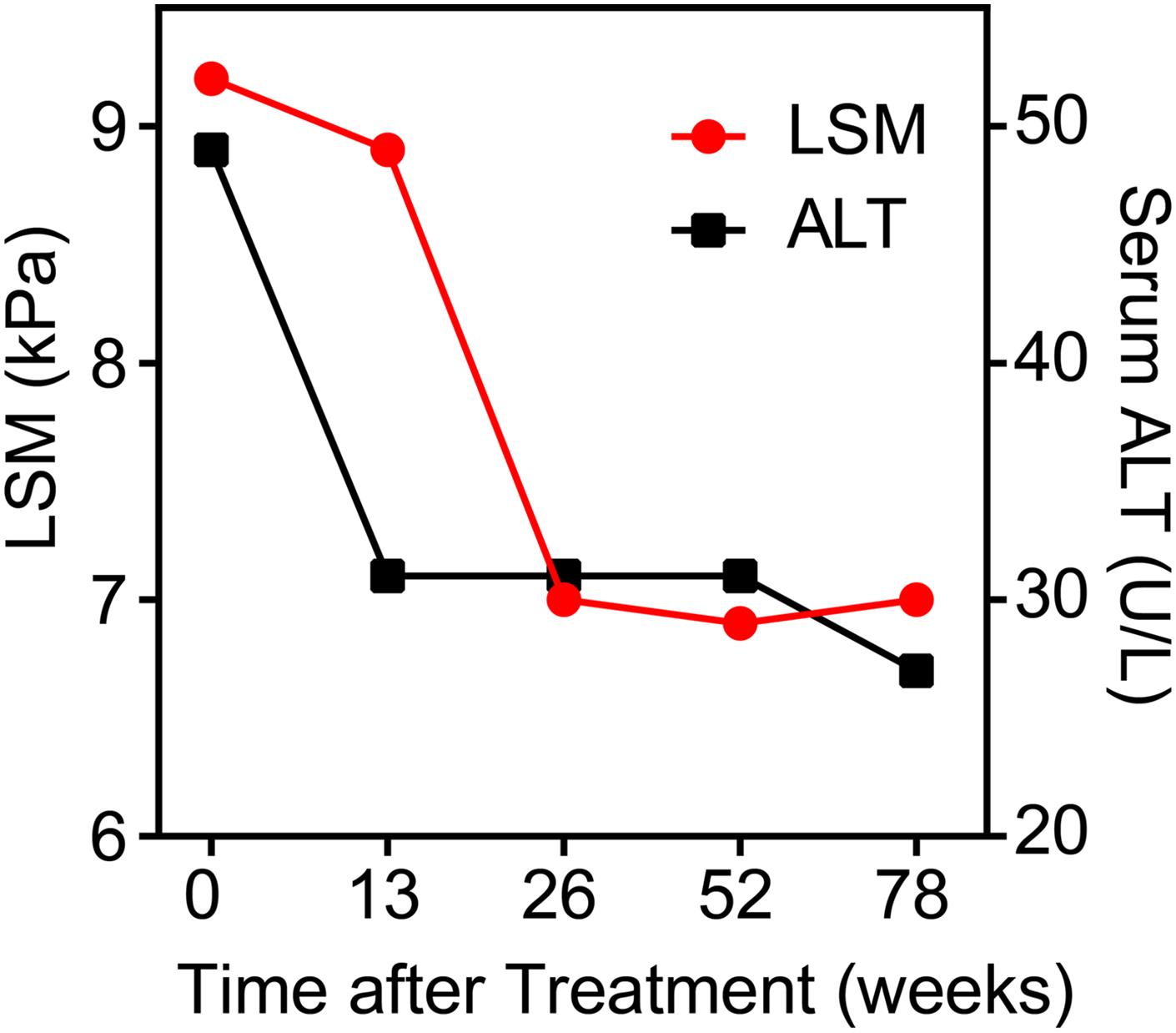In longitudinal cohort LSM and alanine aminotransferase (median±interquartile range) level change during treatment with entecavir.