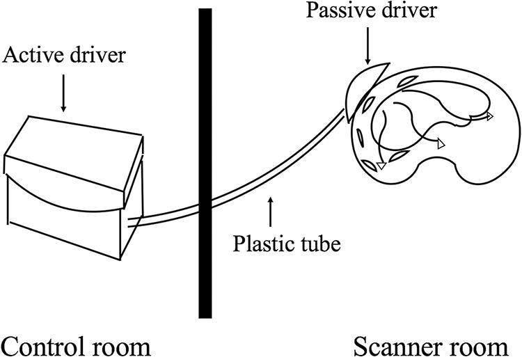 Illustration of the mechanical driver device in MR elastography.