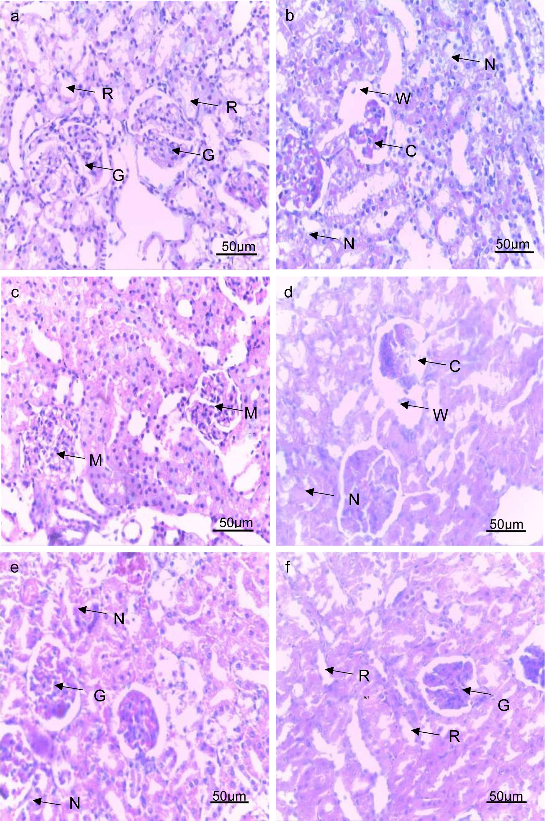 Kidney micrographs.