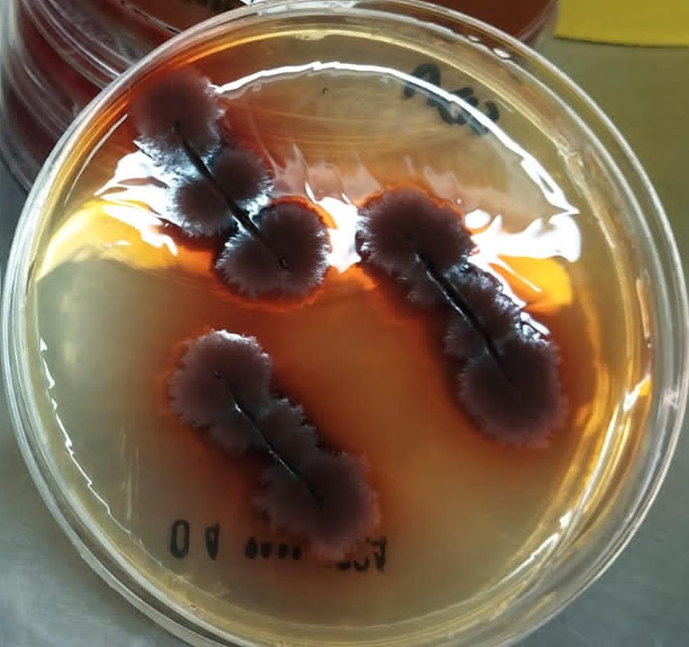Colony morphology of <italic>Exophiala jeanselmei</italic> on Sabouraud dextrose agar.