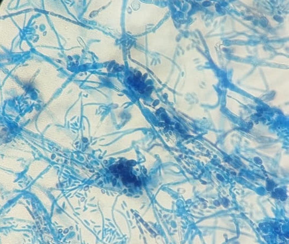 Photomicrograph of colonies of <italic>Exophiala jeanselmei.</italic>