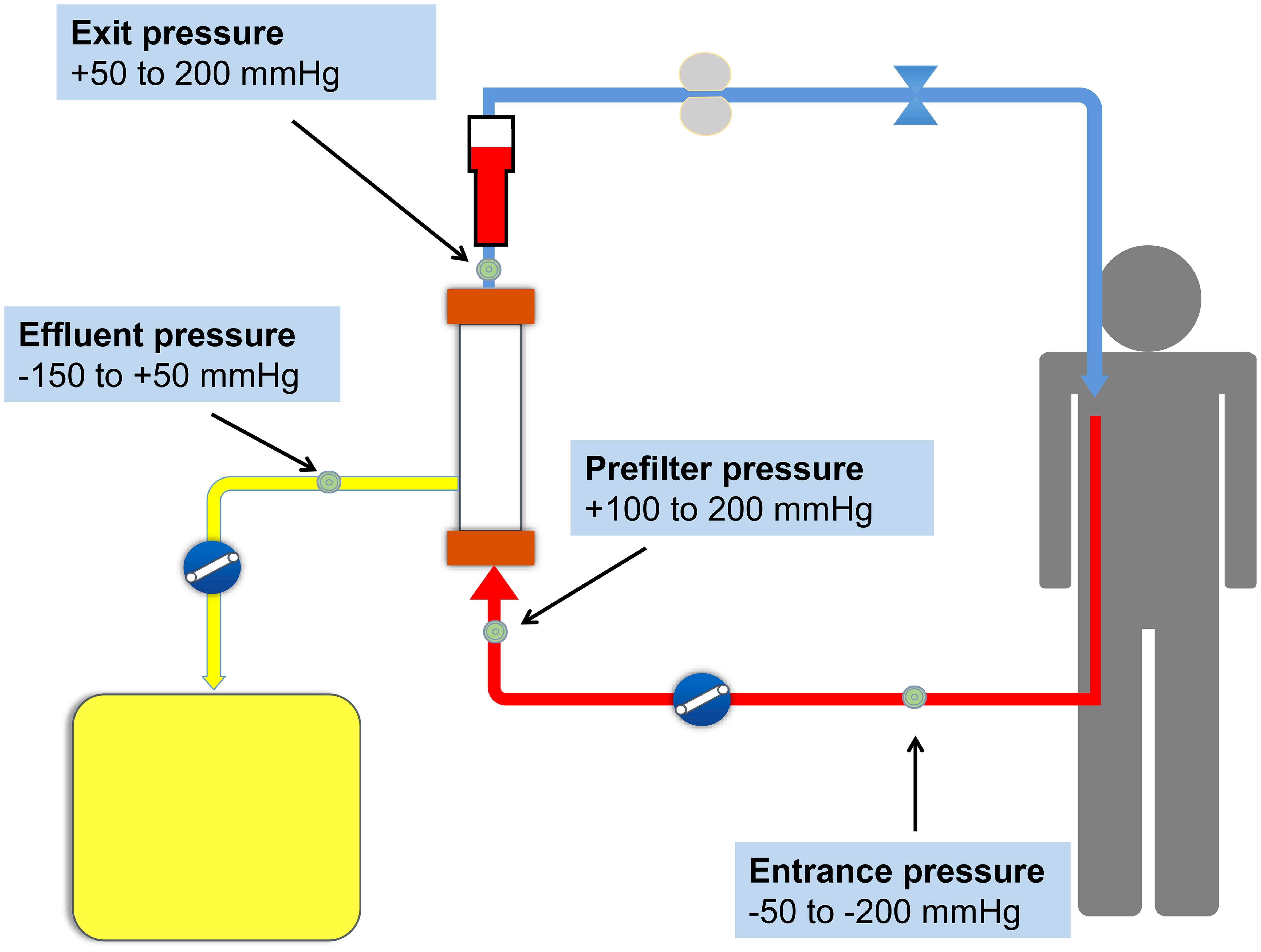 The four measured circuit pressures on a CRRT circuit.