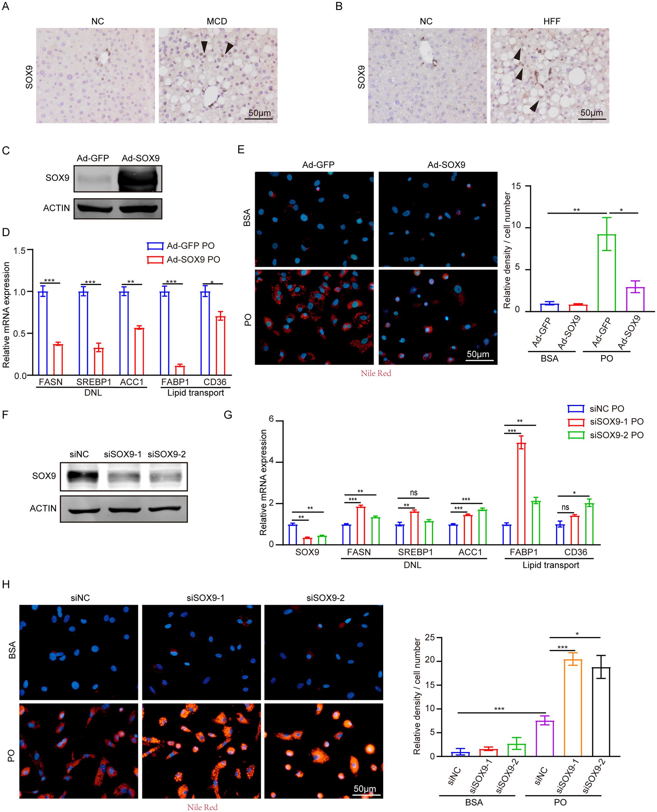 SOX9 suppresses lipid accumulation in HepG2 cells.