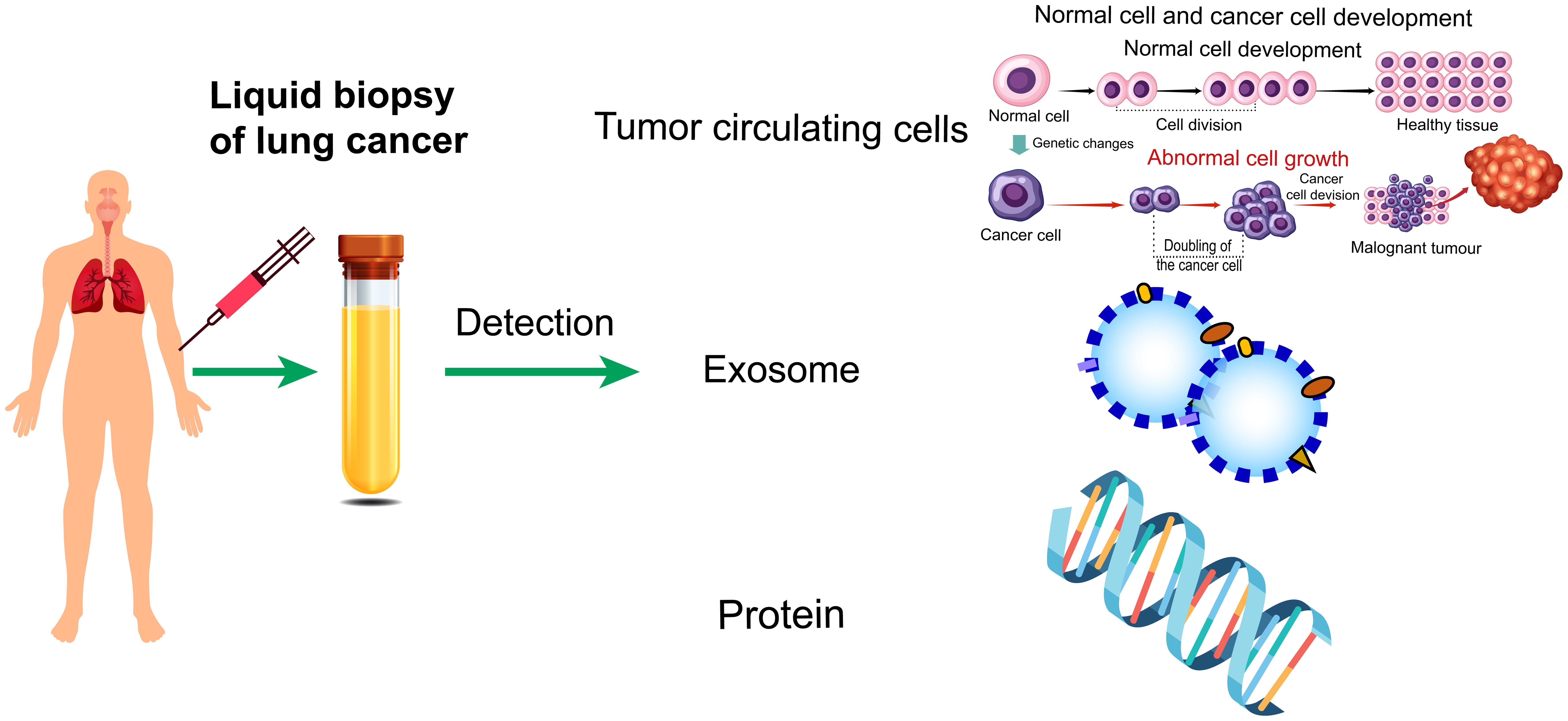 Distribution of key targets for liquid biopsy in lung cancer.