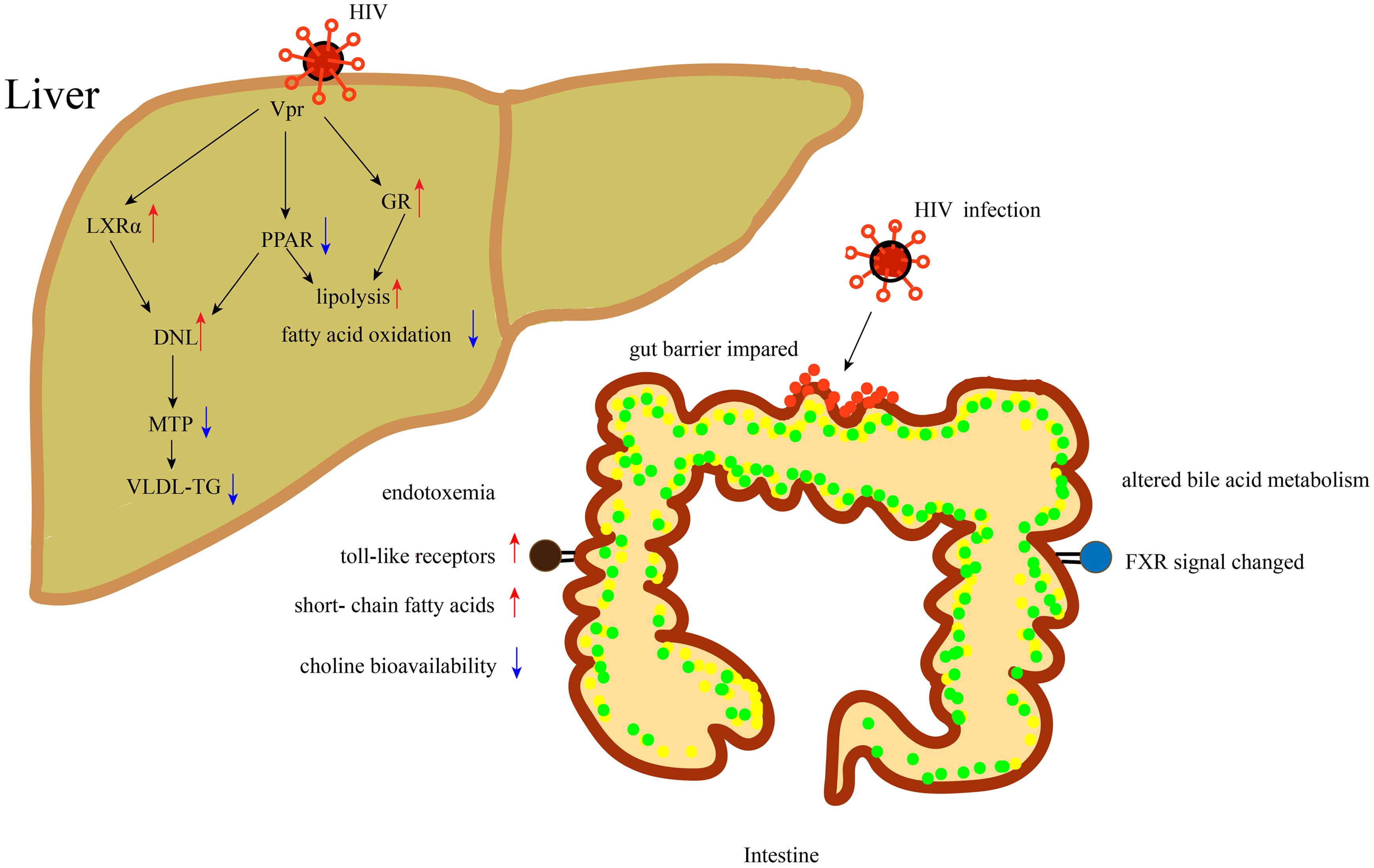 Mechanism of HIV infection affecting the occurrence and development of NAFLD.