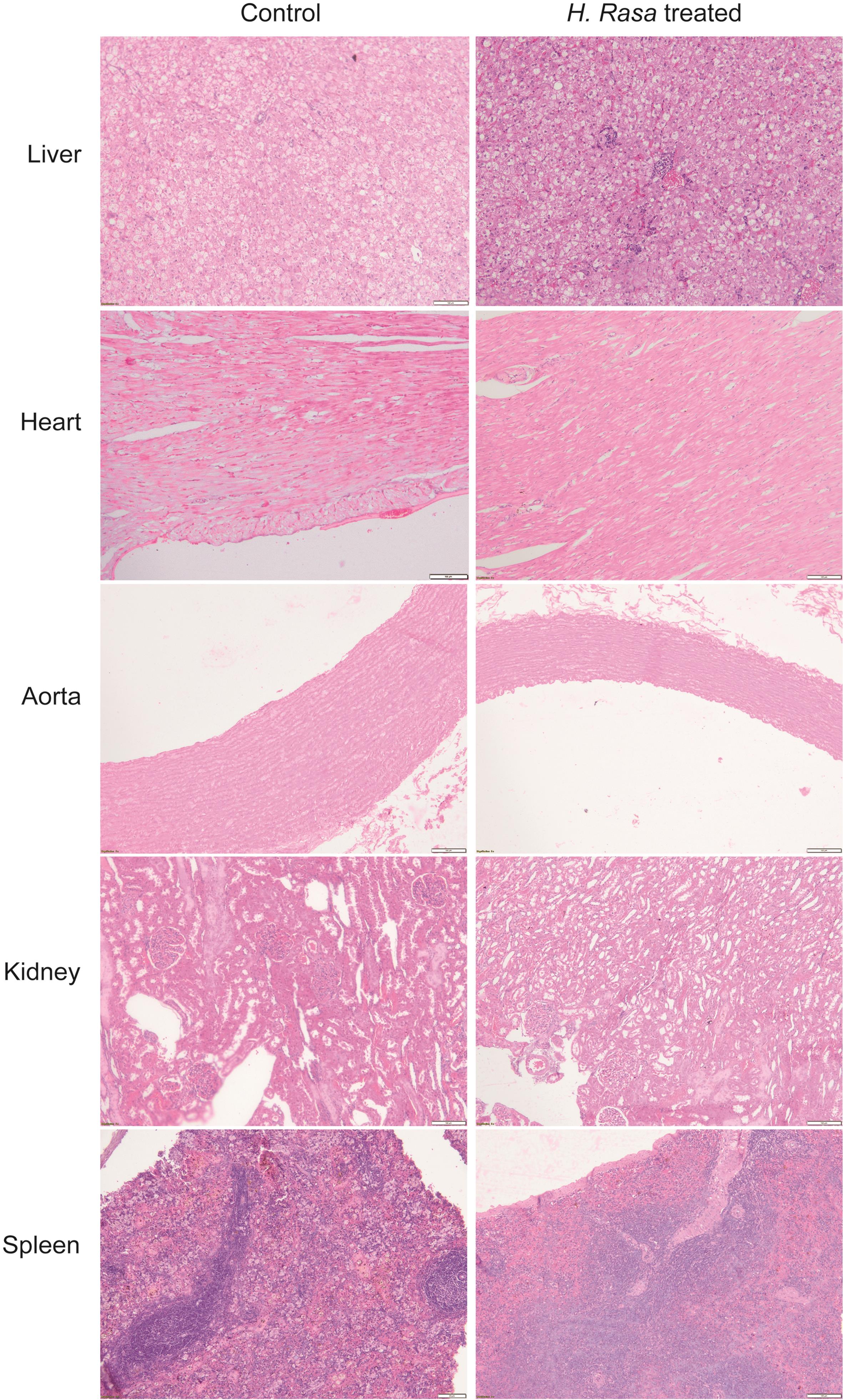 Histopathological findings of major organs in control and high dose of <italic>H. Rasa</italic> treated groups (10 × 10X).