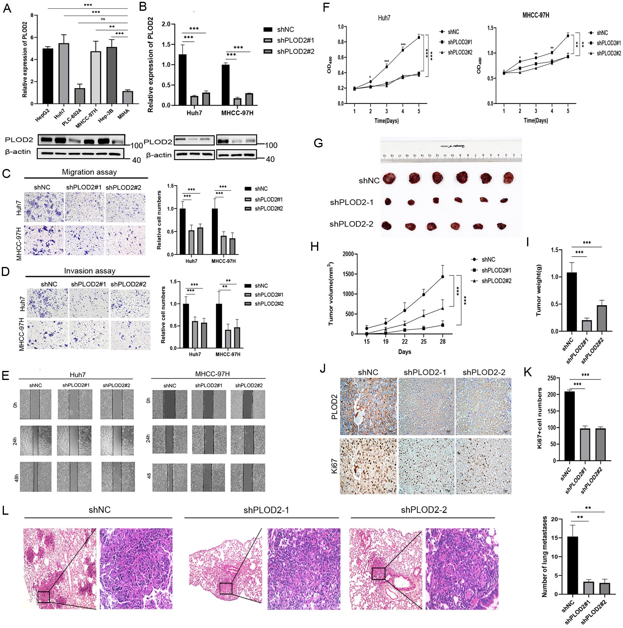 KD of PLOD2 decreased the metastasis and invasion of HCC cells <italic>in vitro</italic> and <italic>in vivo</italic>.