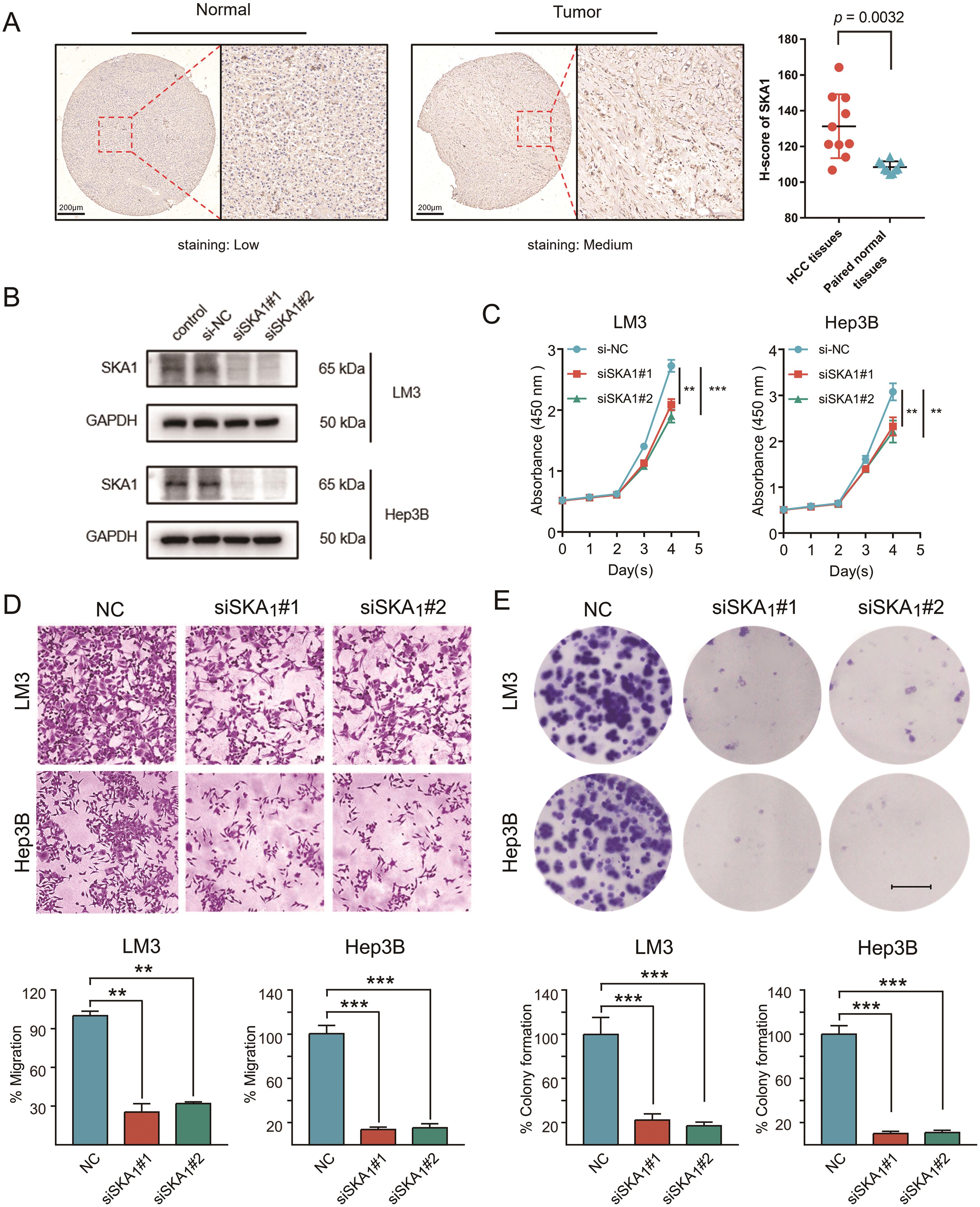Knockdown of SKA1 suppressed the proliferation and invasion abilities of HCC cells.