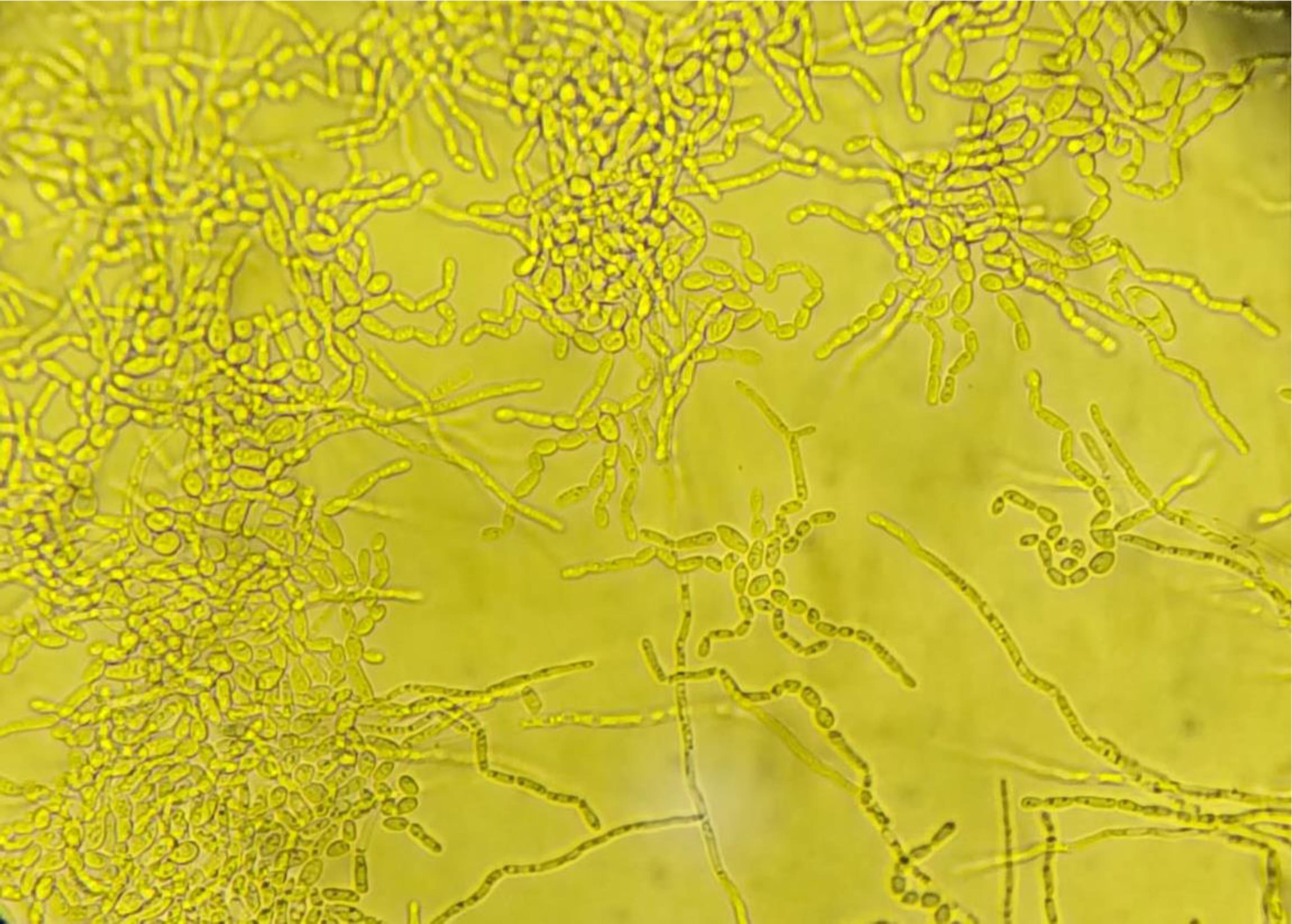 Microscopic appearance of <italic>Trichosporon asahii</italic> colonies cultured on cornmeal-Tween 80 agar (Magnification: 40×).