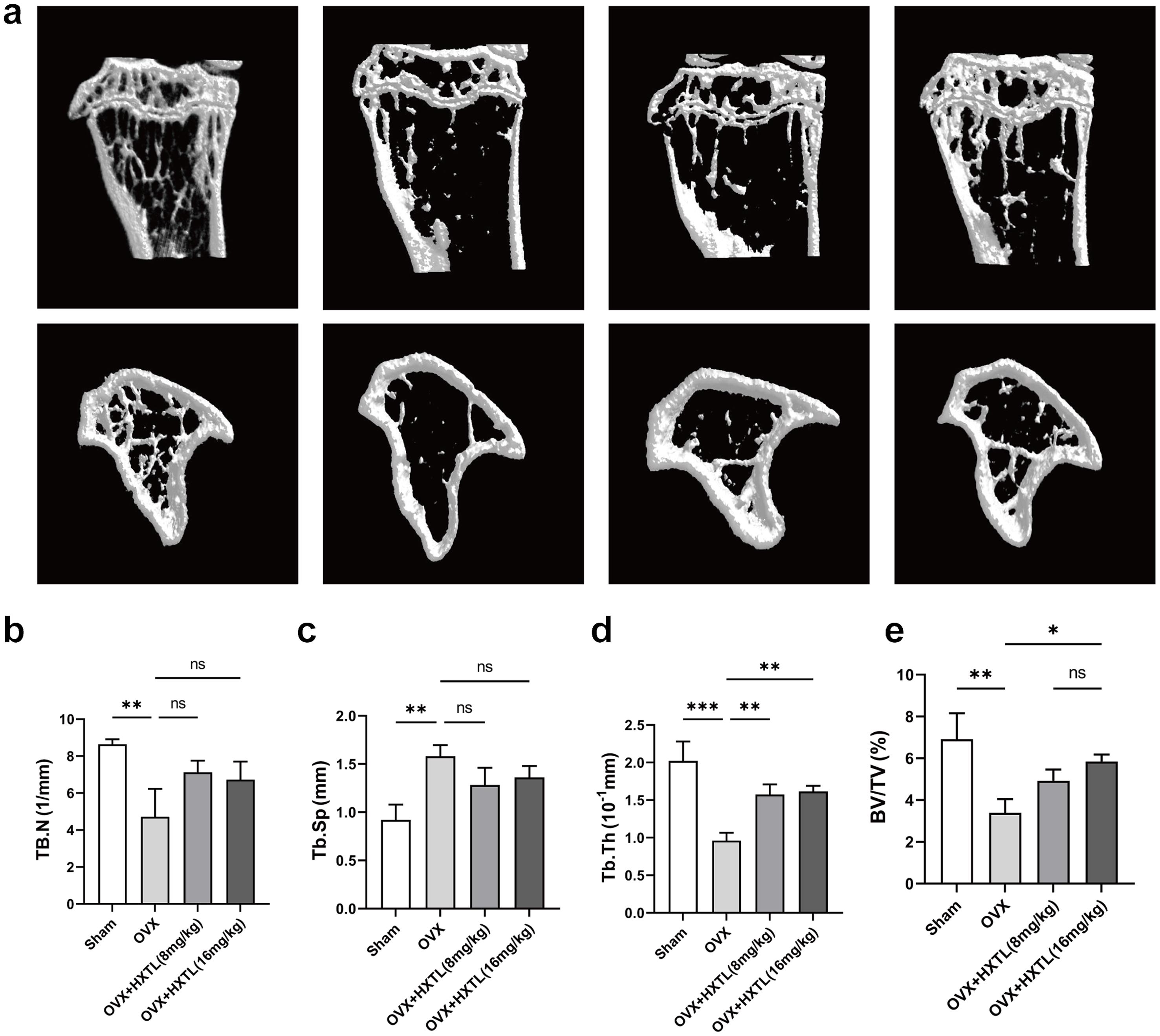 HXTL attenuated bone mass loss in the OVX model.