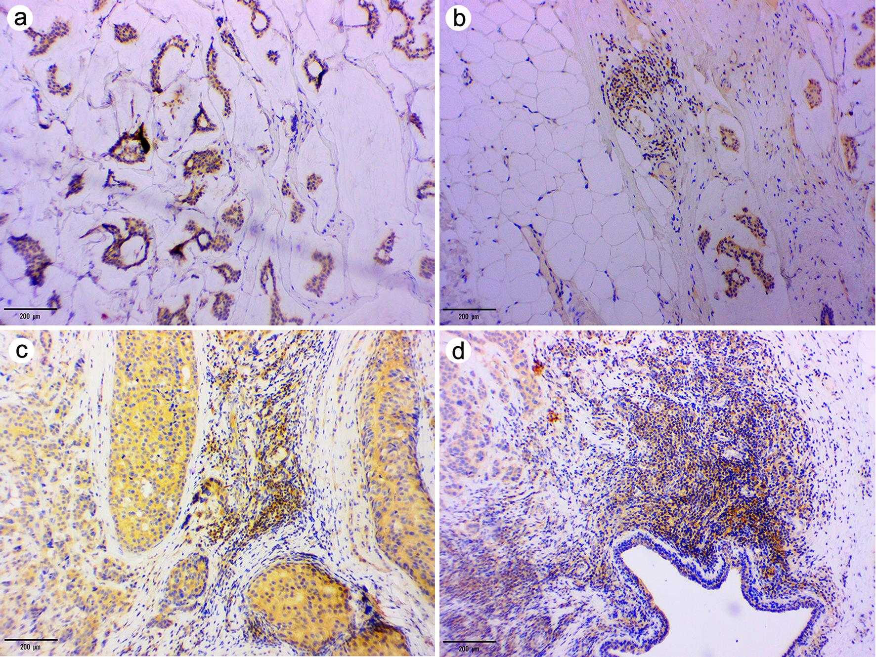 Examples of CXCR4 expression intensity in immune cells.