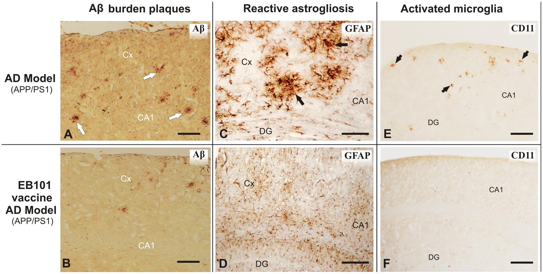 Effect of EB101 vaccine on Aβ deposits, astroglia and microglia in APP/PS1 mouse brain. 