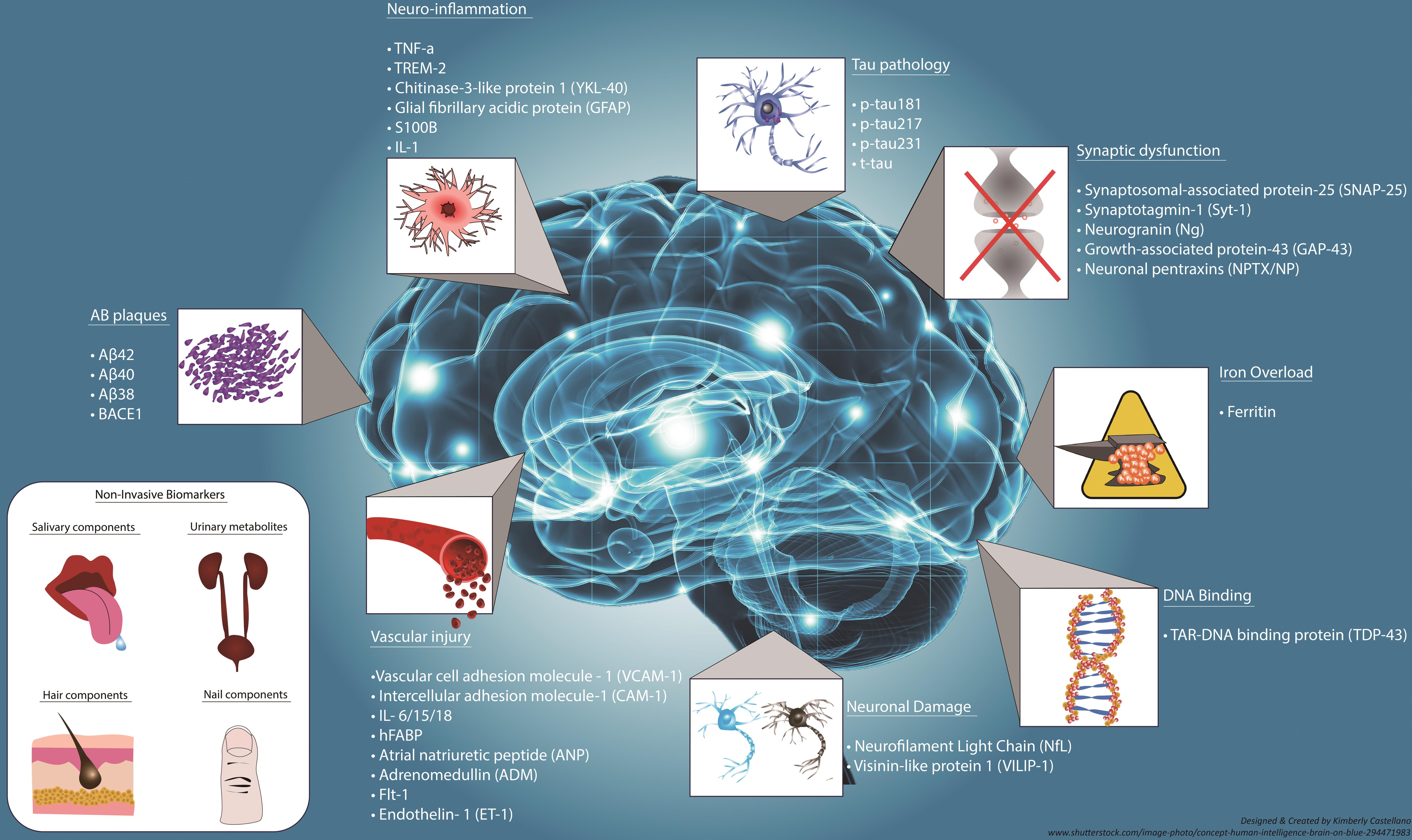 Biomarkers and Their Implications in Alzheimer’s Disease A Literature