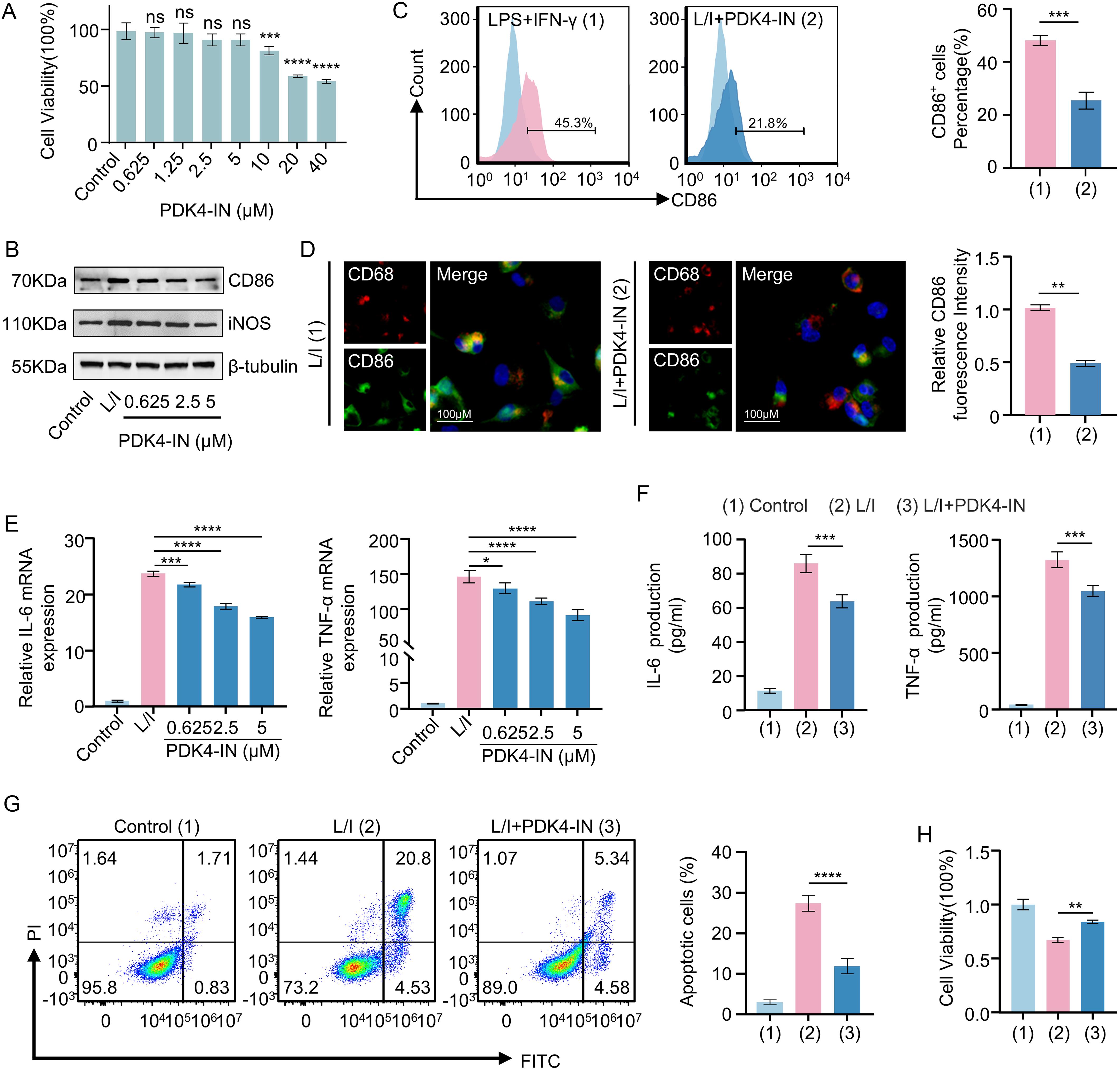 Effects of PDK4 inhibition on M1 polarization in THP-1 macrophages and hepatocyte injury.