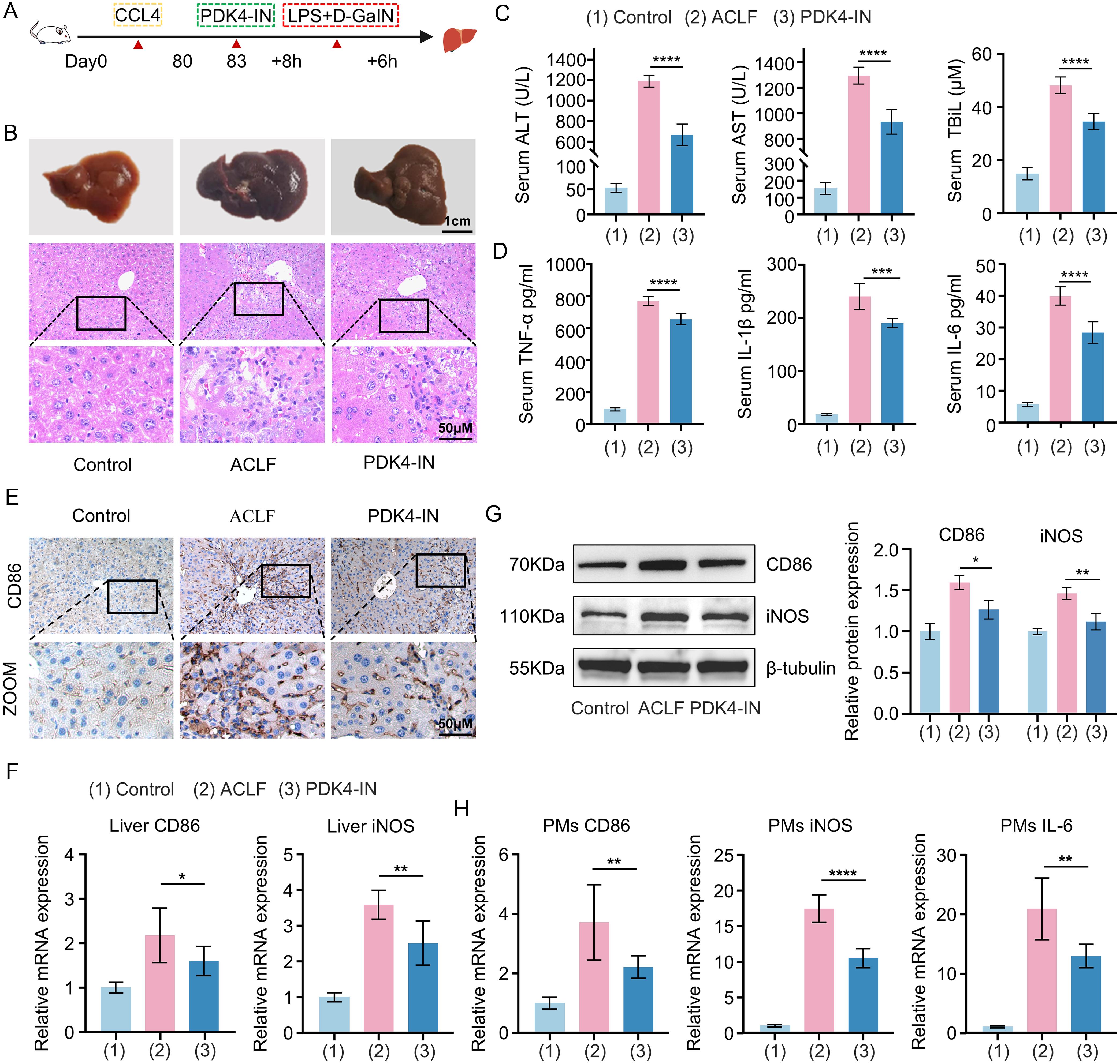 Effects of PDK4 inhibition on hepatic injury and macrophage M1 polarization in mice with ACLF.