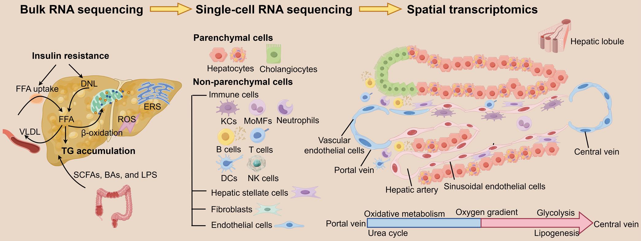 Multi-dimensional transcriptomic approaches to elucidate MAFLD pathogenesis.