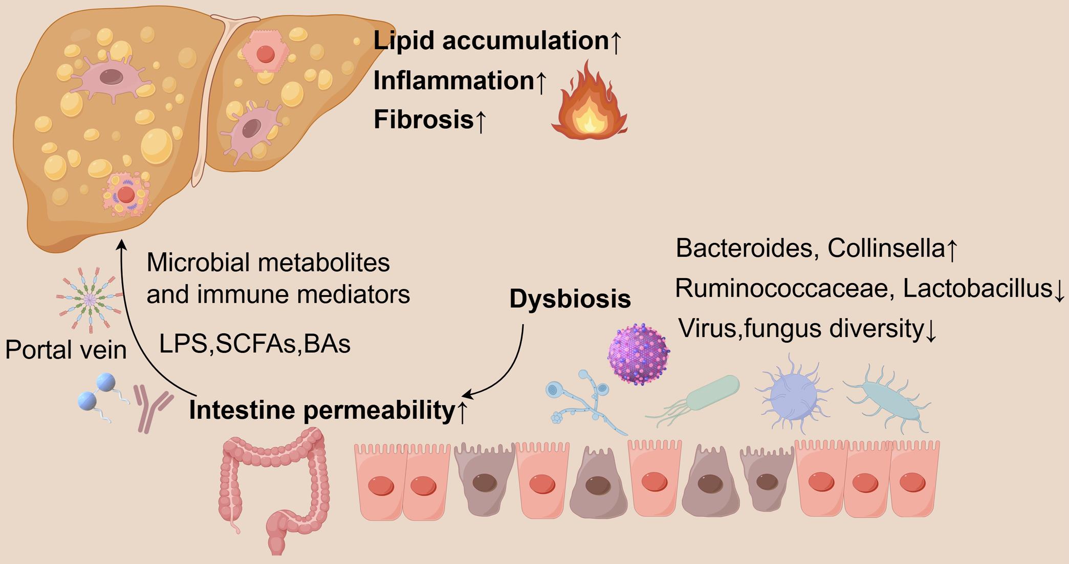 The gut-liver axis in MAFLD progression.