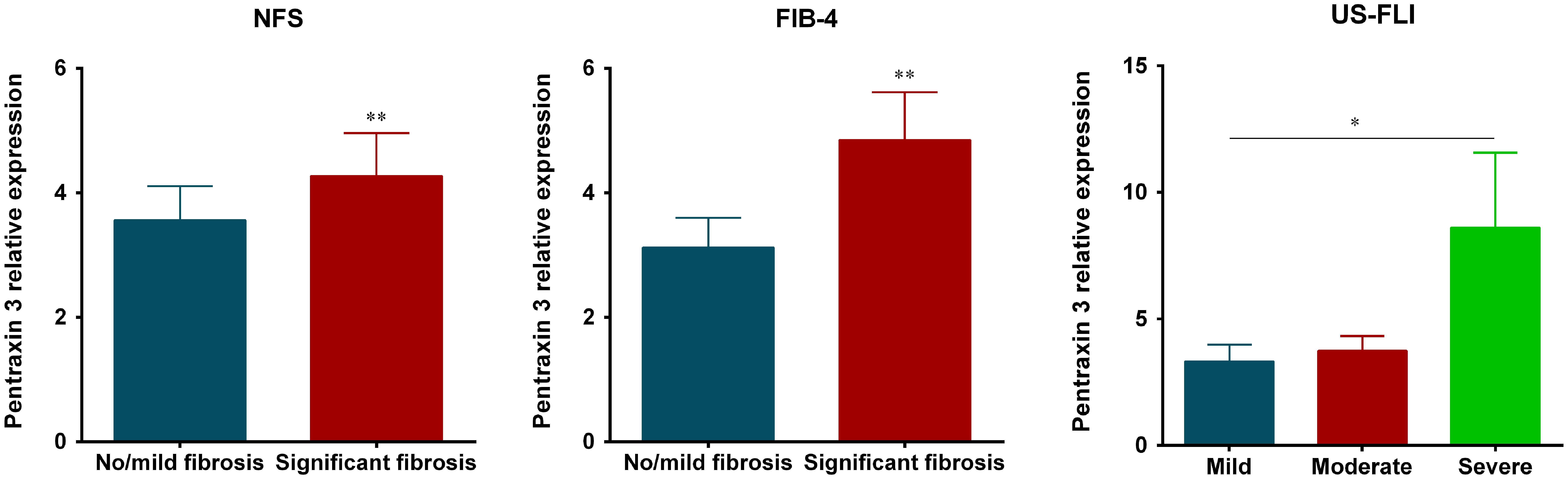 Sensitivity, specificity, and AUC of pentraxin 3 in advanced fibrosis.
