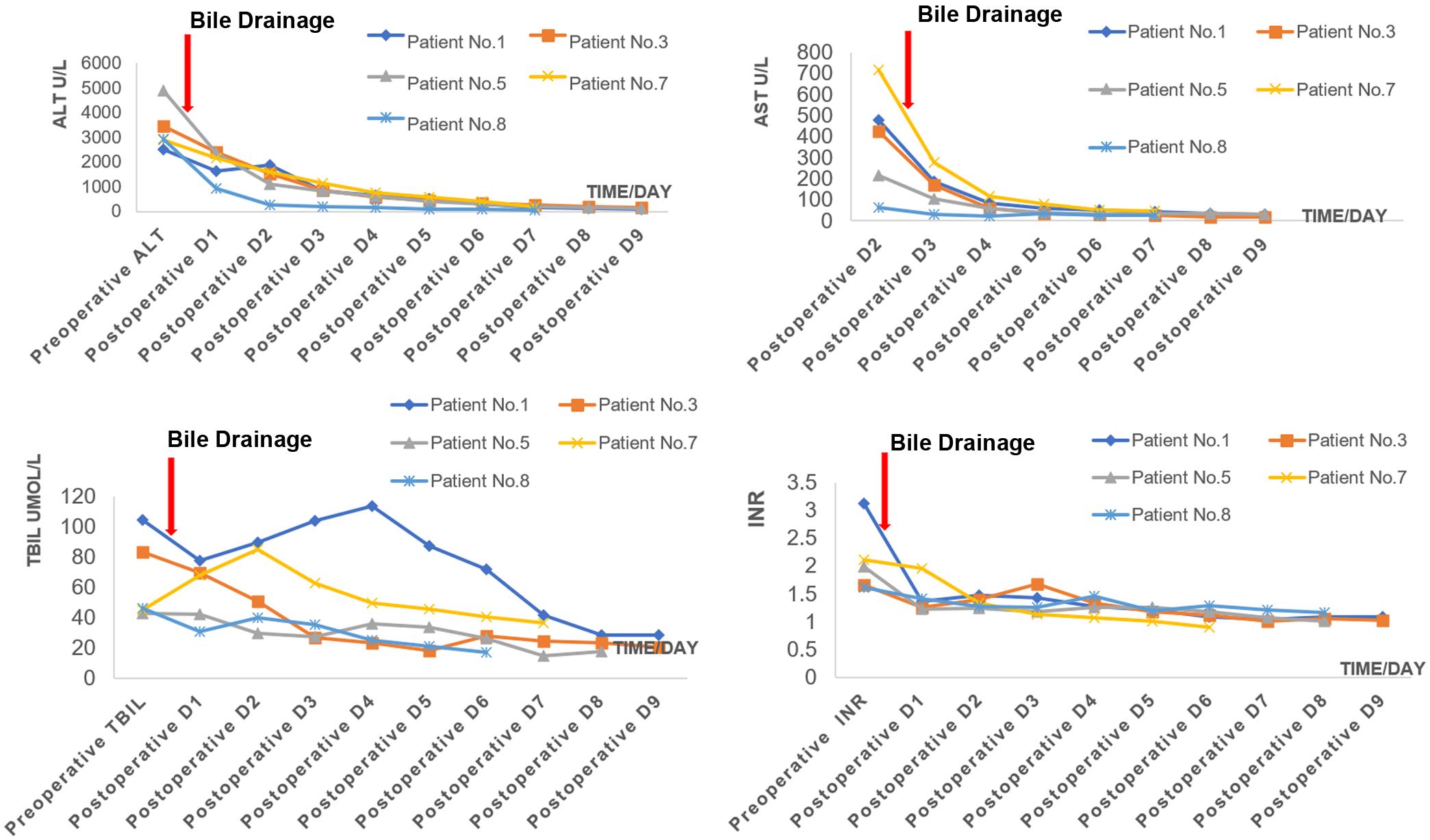 Dynamic changes in serum liver enzymes and coagulation parameters after bile drainage.