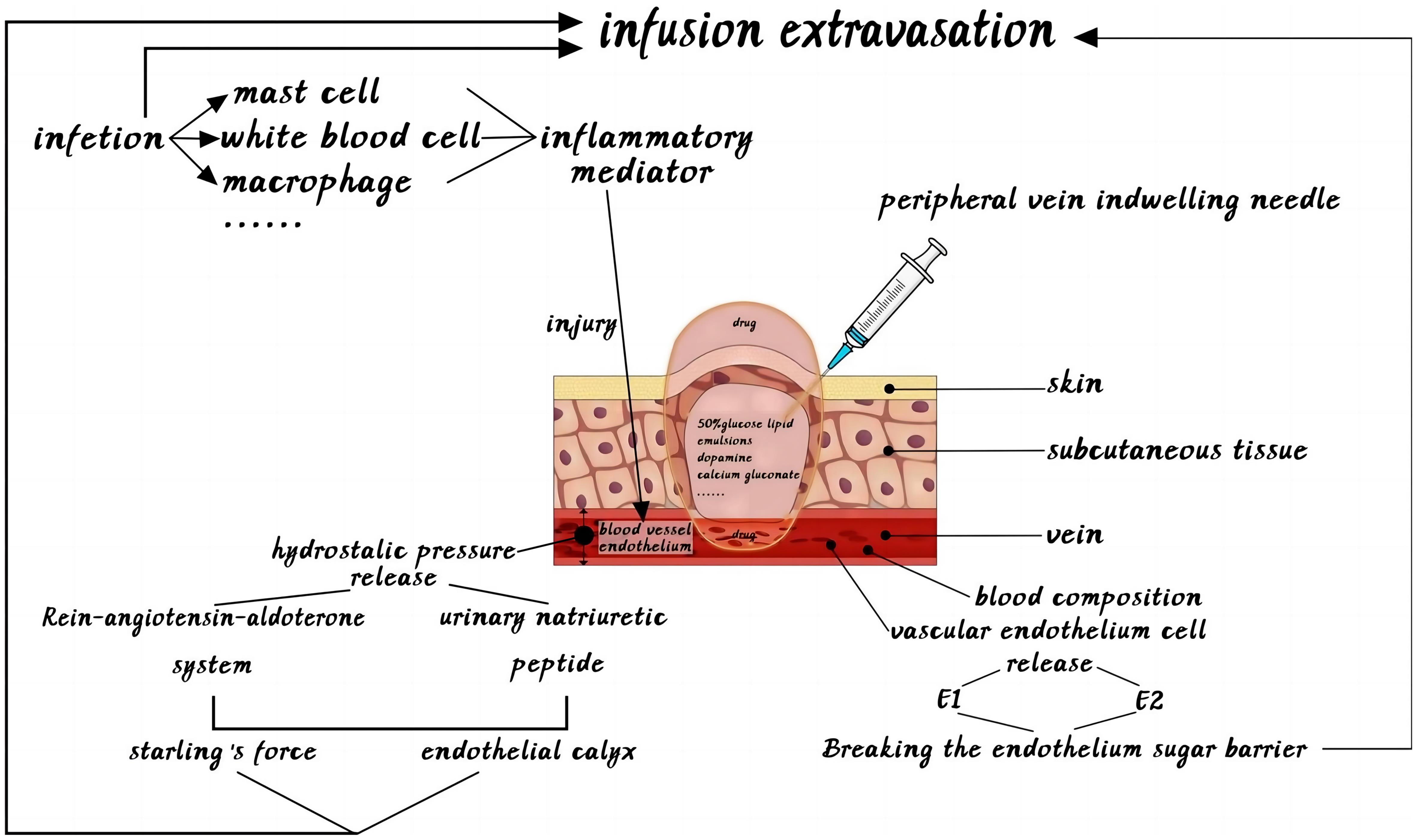 The mechanism of infusion extravasation.