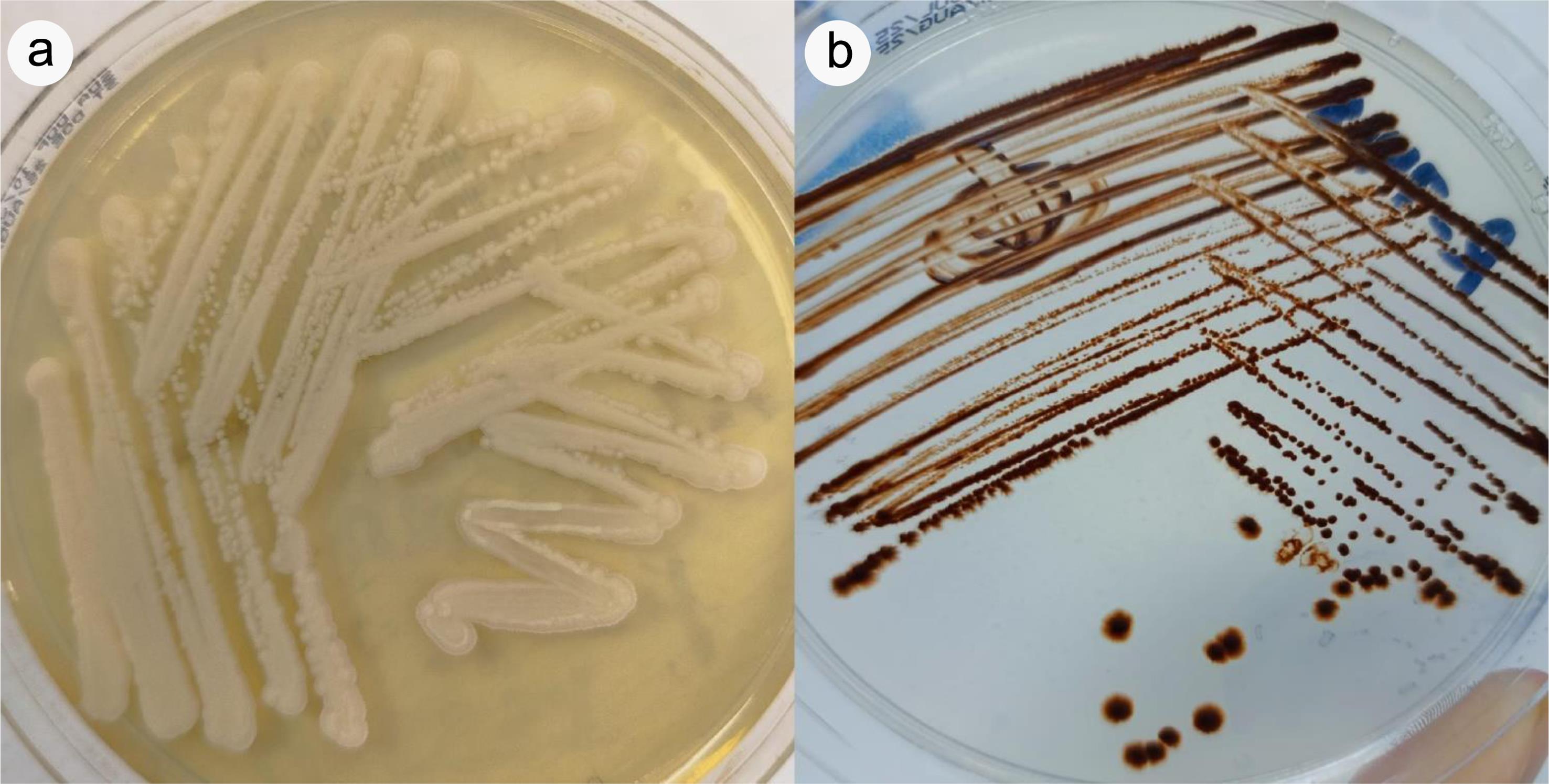 Colony morphology of <italic>Trichosporon asahii</italic> on (a) Sabouraud dextrose agar and (b) Bismuth glucose glycine yeast agar.
