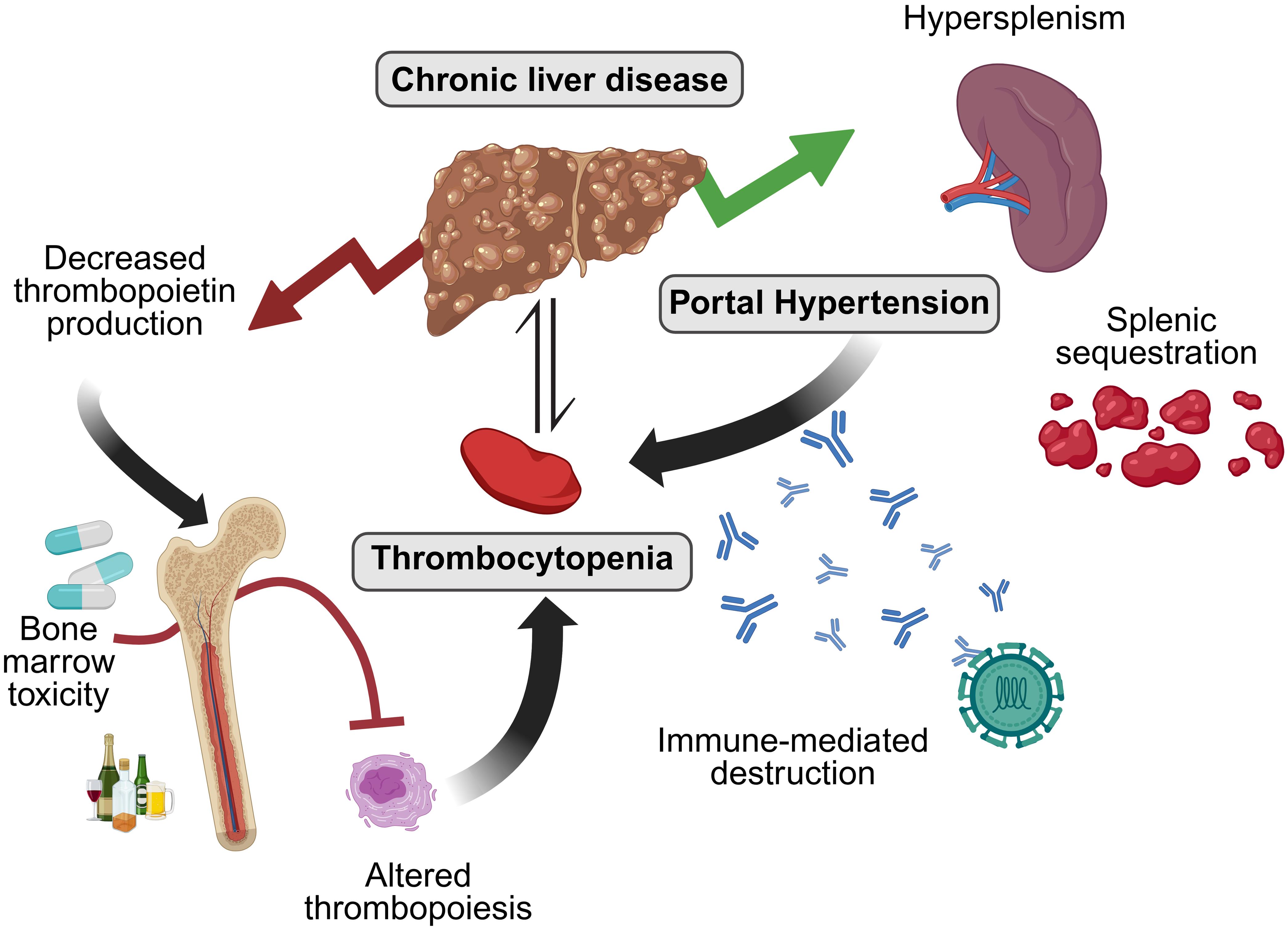 Pathophysiological mechanisms of thrombocytopenia in patients with portal hypertension and chronic liver disease.