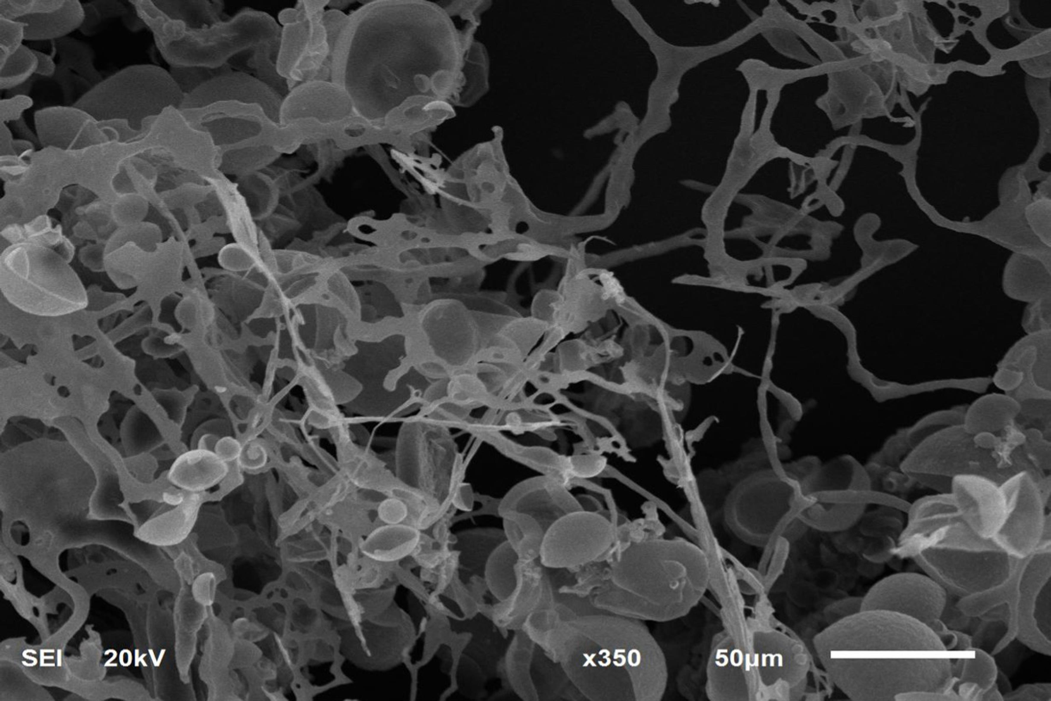 Scanning electron microscopy photographs of ibuprofen-loaded floating nanoballoons.