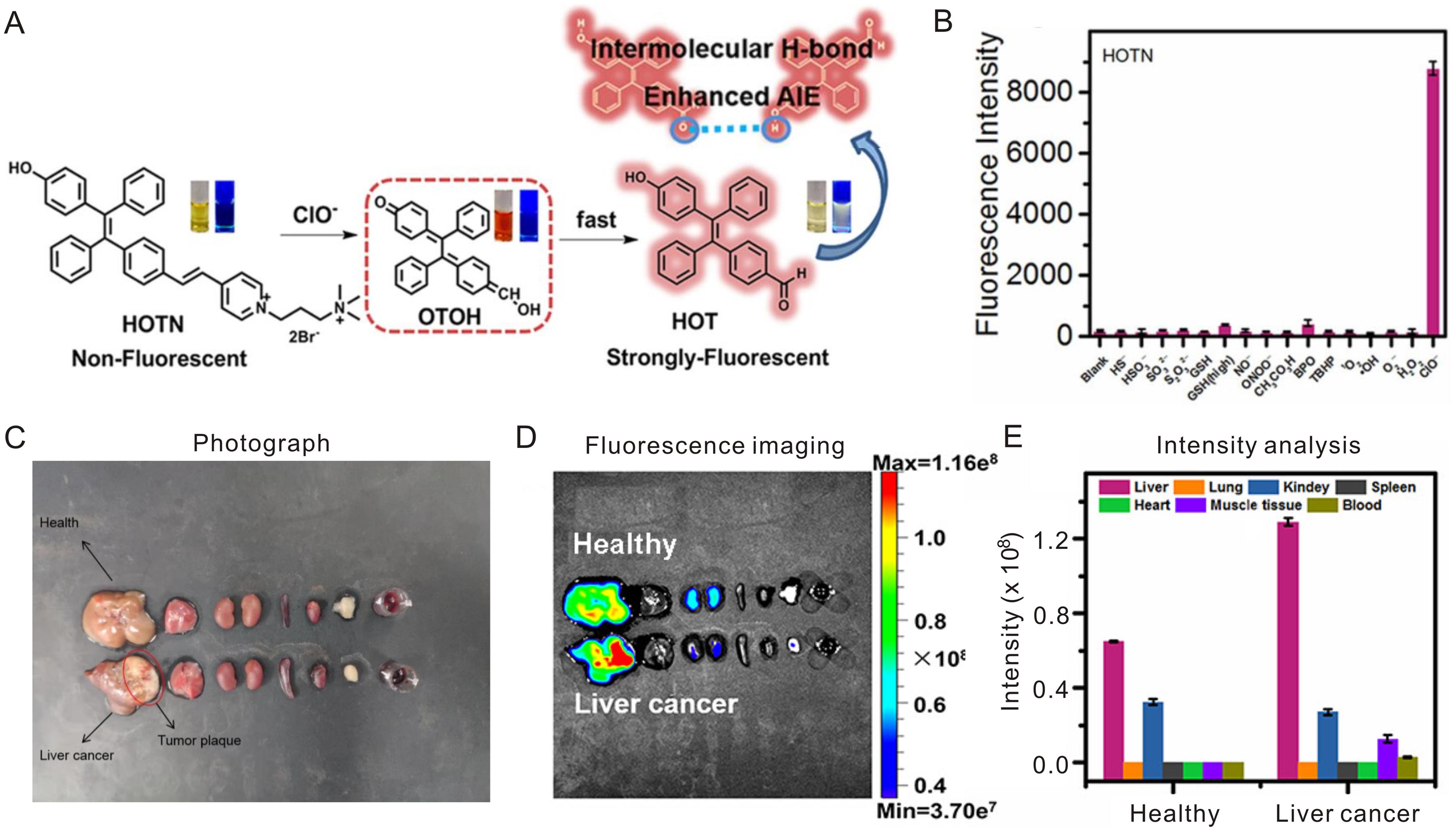 Response mechanism and fluorescence imaging of AIE-active HOTN and ClO<sup>−</sup> in liver cancer and normal tissues.