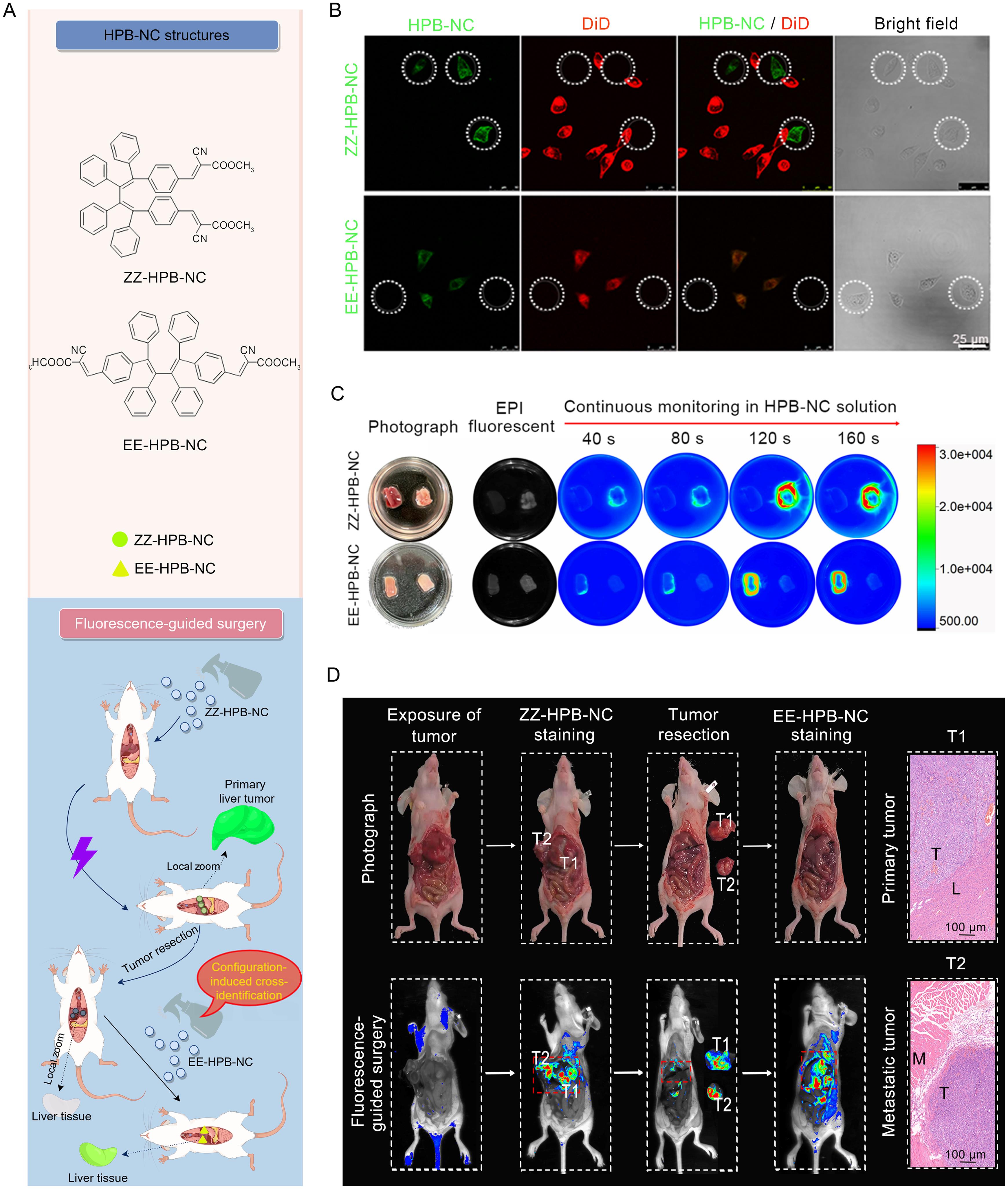 Cis-trans isomerized HPB-NC molecules for configuration-induced cross-identification imaging and mouse liver tumor resection through fluorescence navigation.