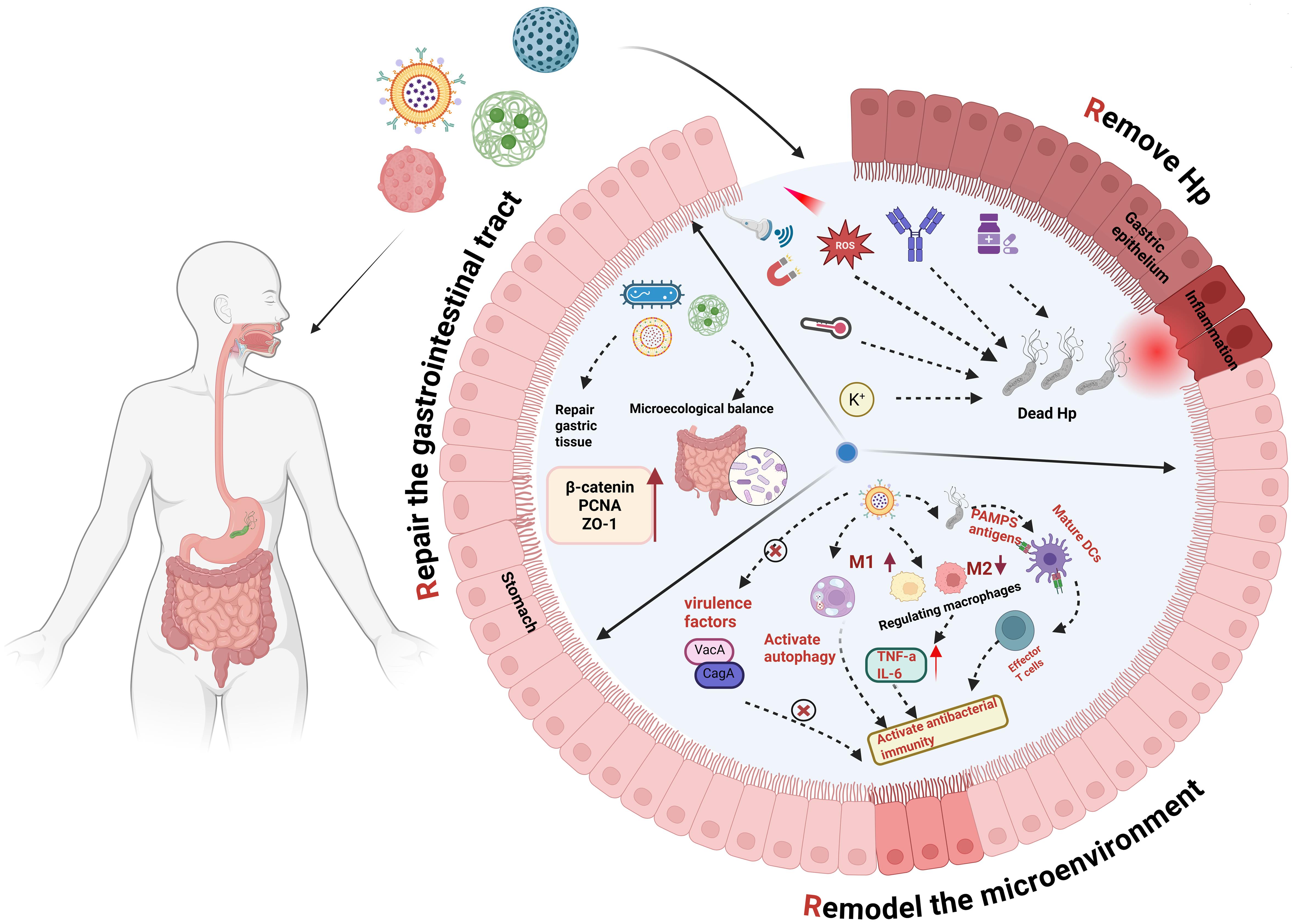 Schematic diagram of 3R (Remove, Remodel, Repair) integrated therapy for <italic>H. pylori</italic> infection based on nanomaterials.