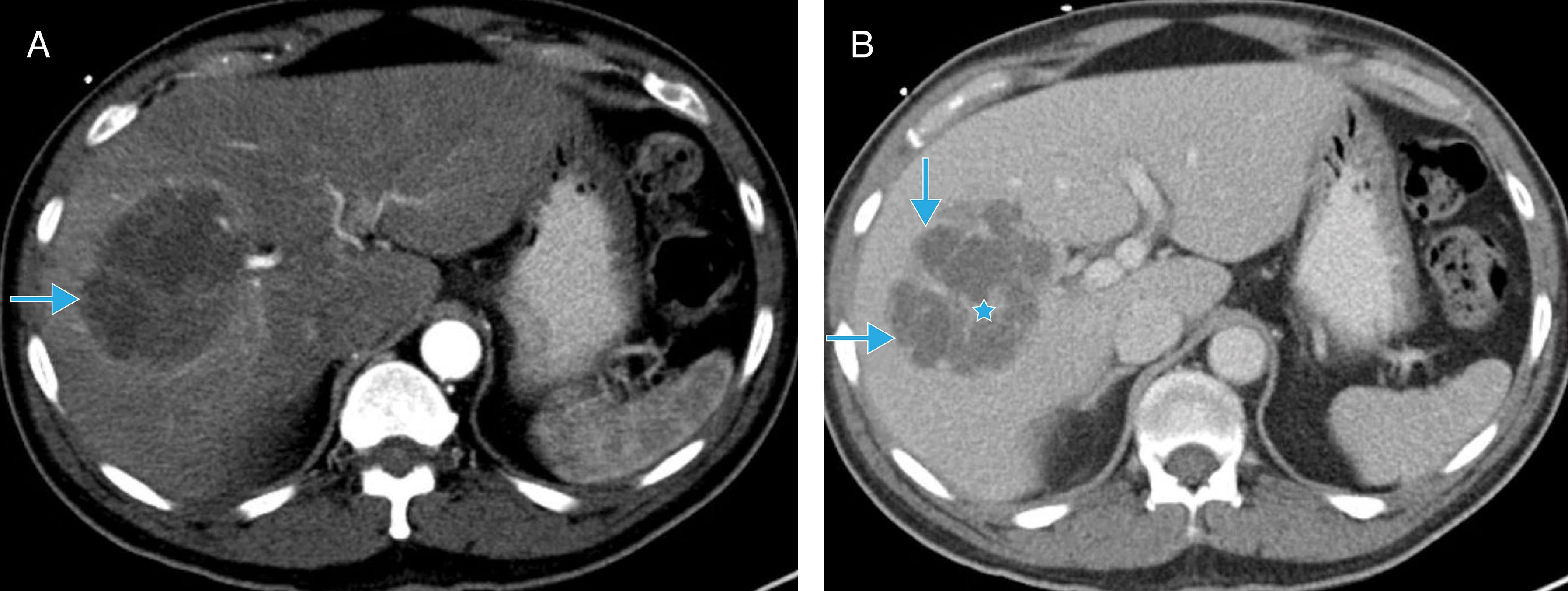 Dynamic contrast-enhanced computed tomography (CT).