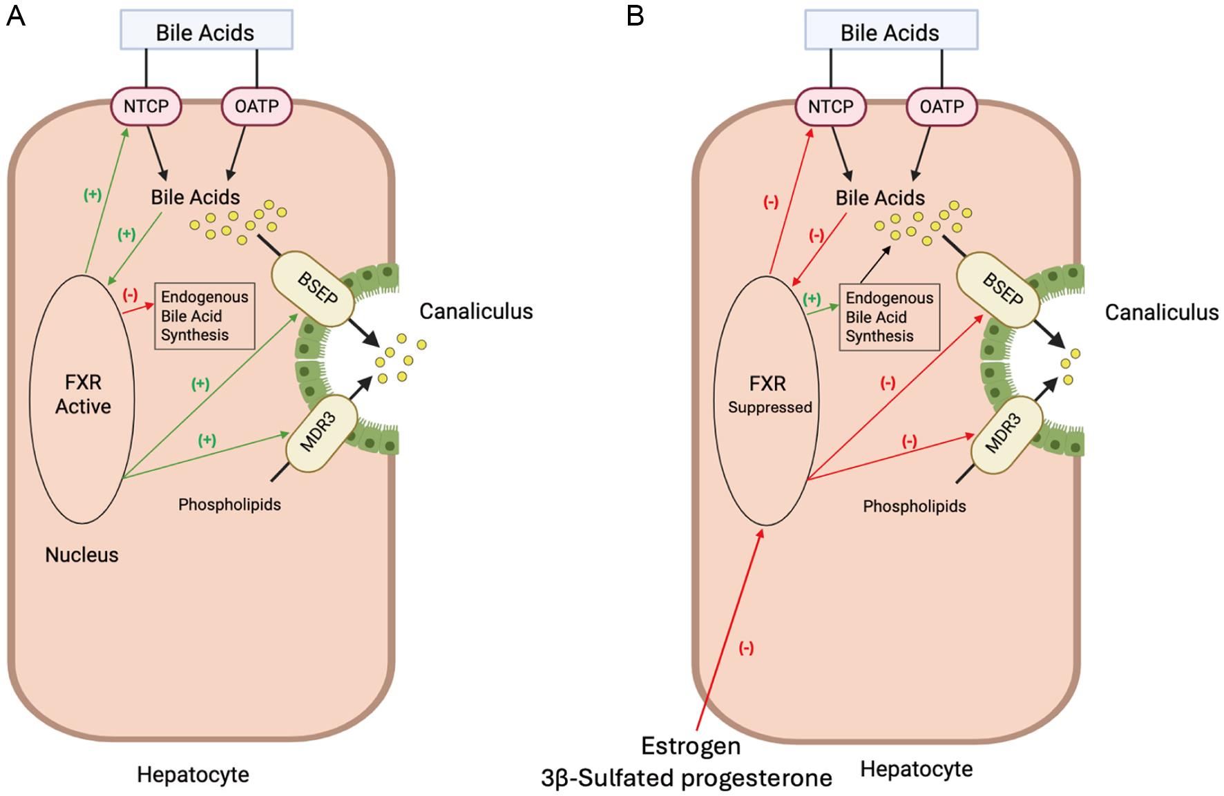 Normal and disrupted bile acid transport and regulation in hepatocytes.