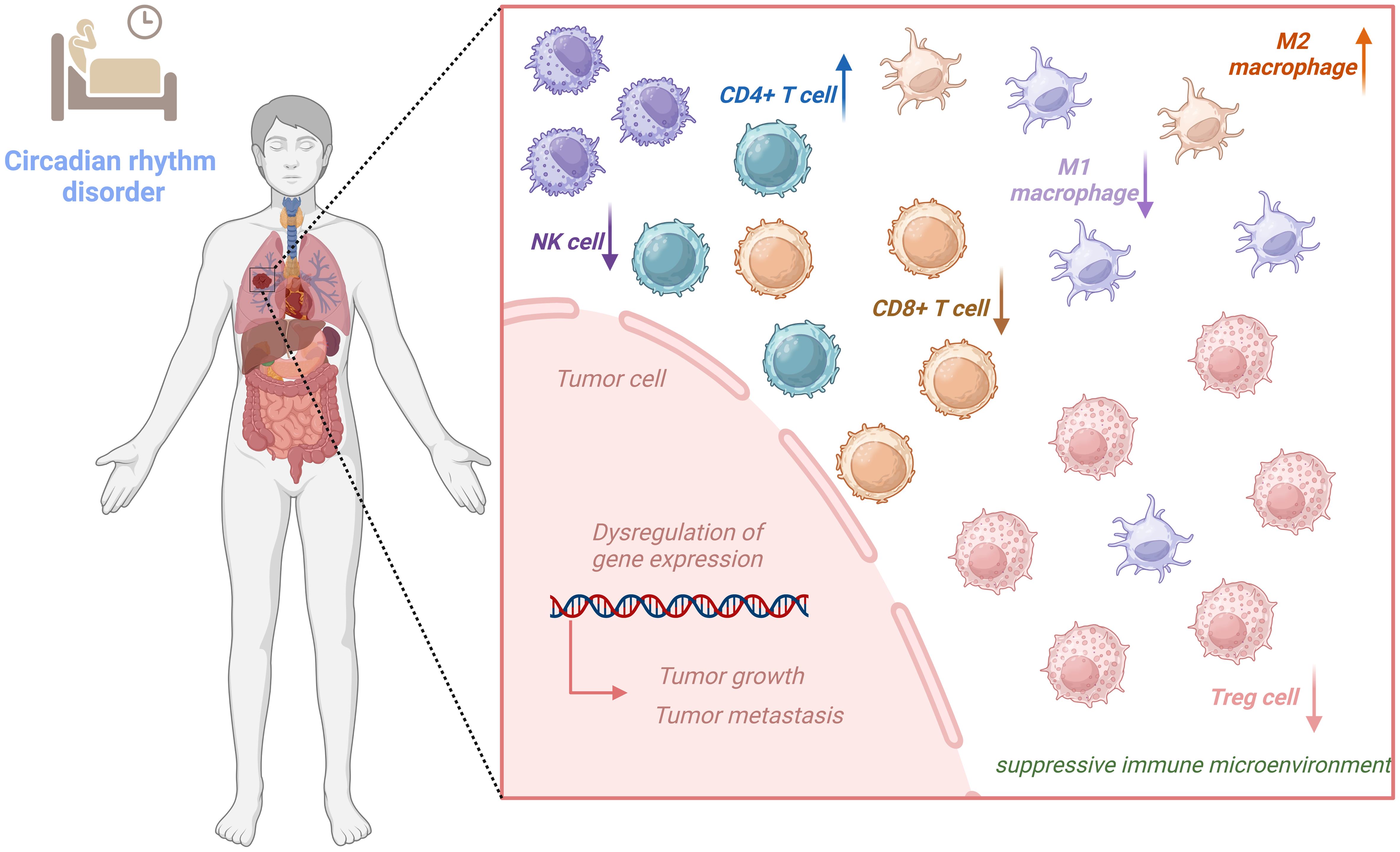 Impact of circadian rhythm disorder on tumor progression and immune microenvironment.