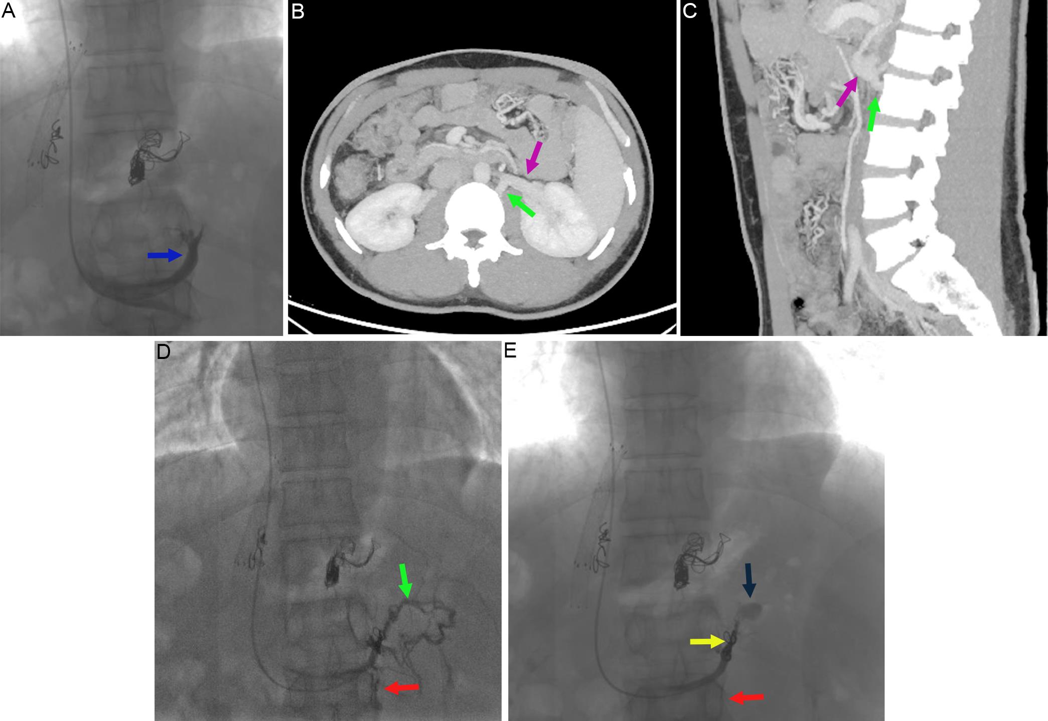 Imaging and angiography findings of the patient.