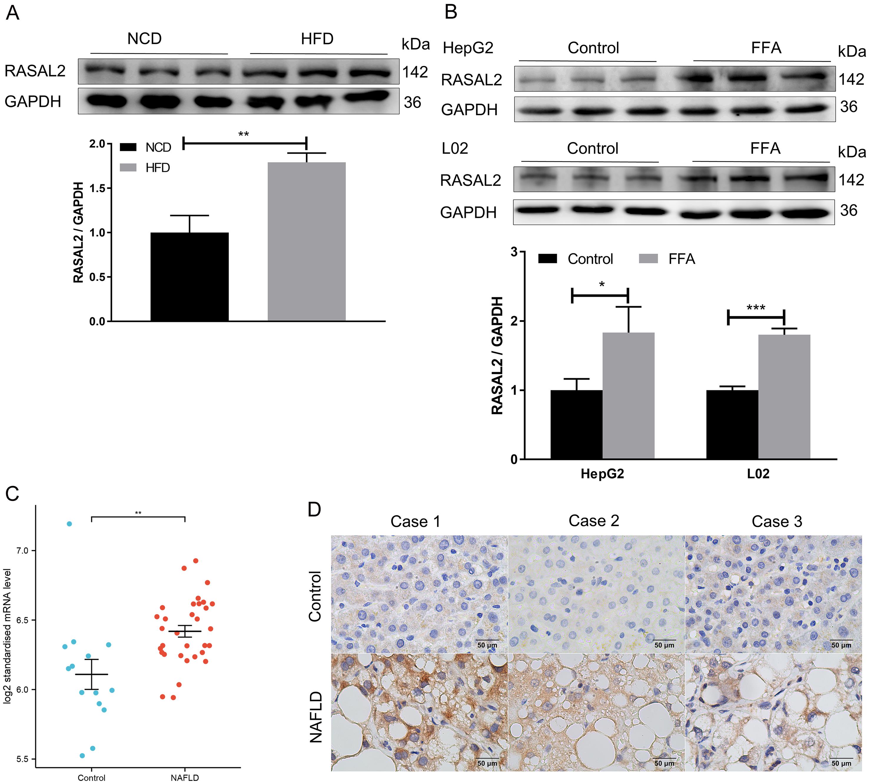 RAS protein activator like 2 (RASAL2) expression is upregulated in steatotic livers.