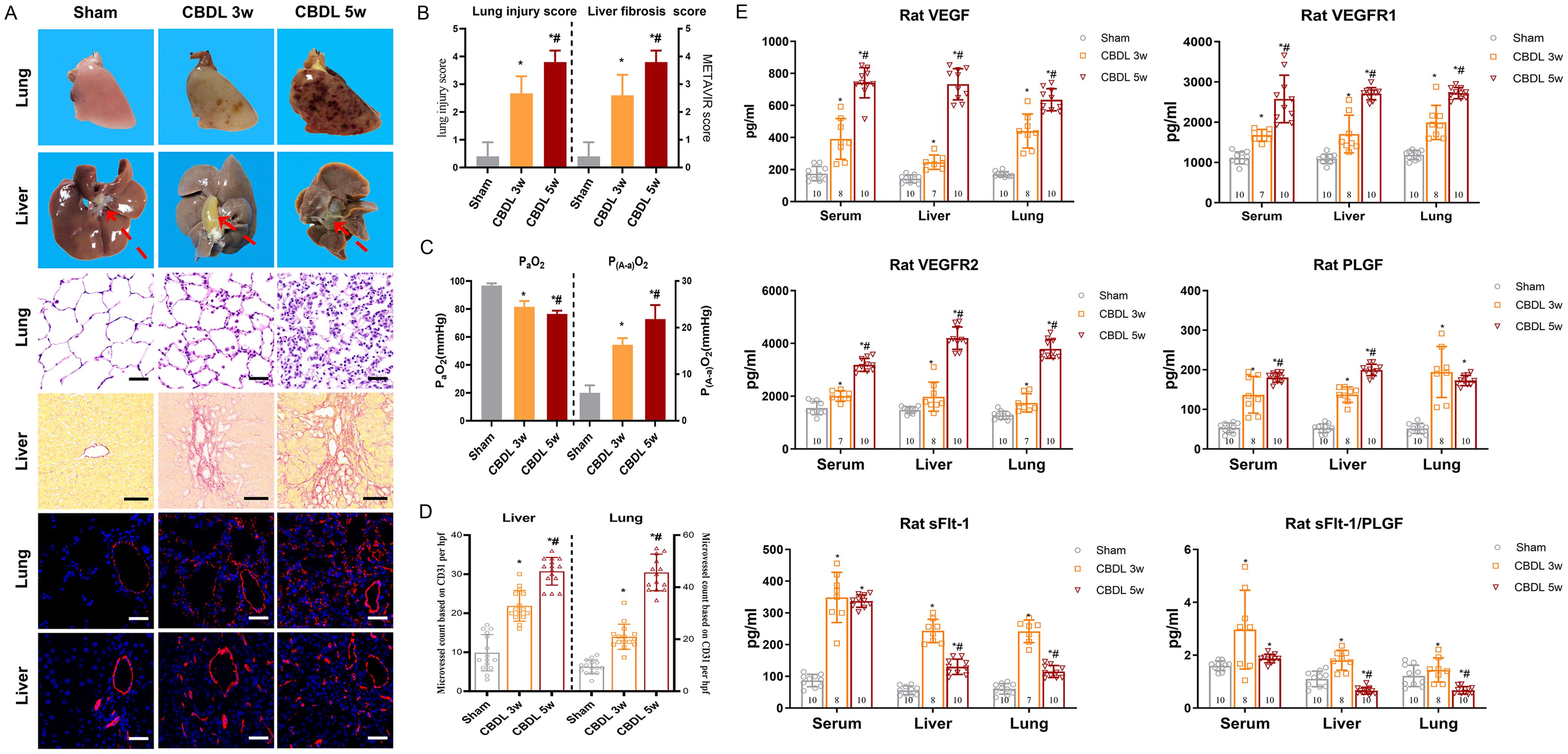 Pathophysiologic changes and levels of the VEGF family members and their receptors after CBDL.