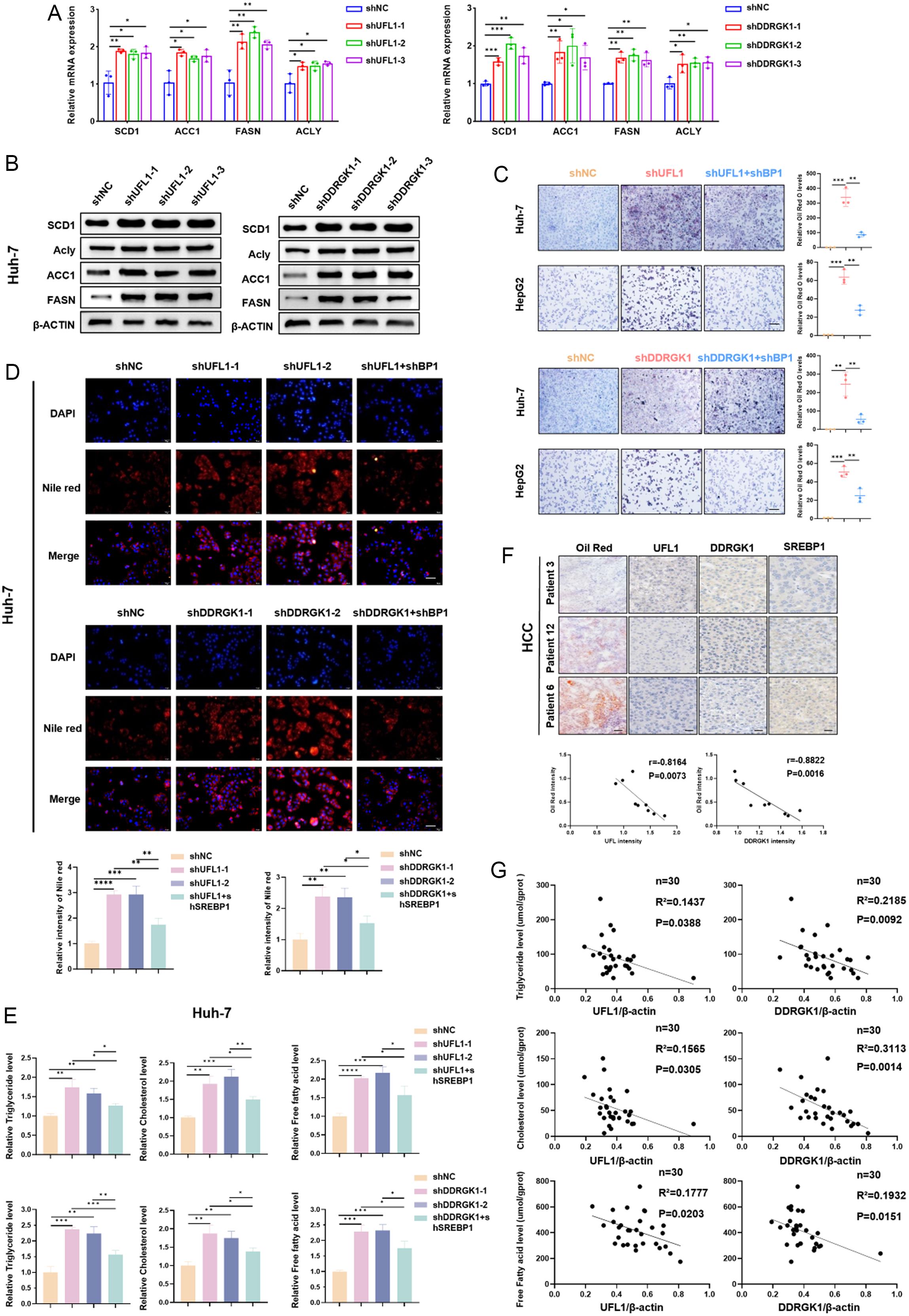 The effects of SREBP1 DysUFMylation on downstream lipid metabolism.