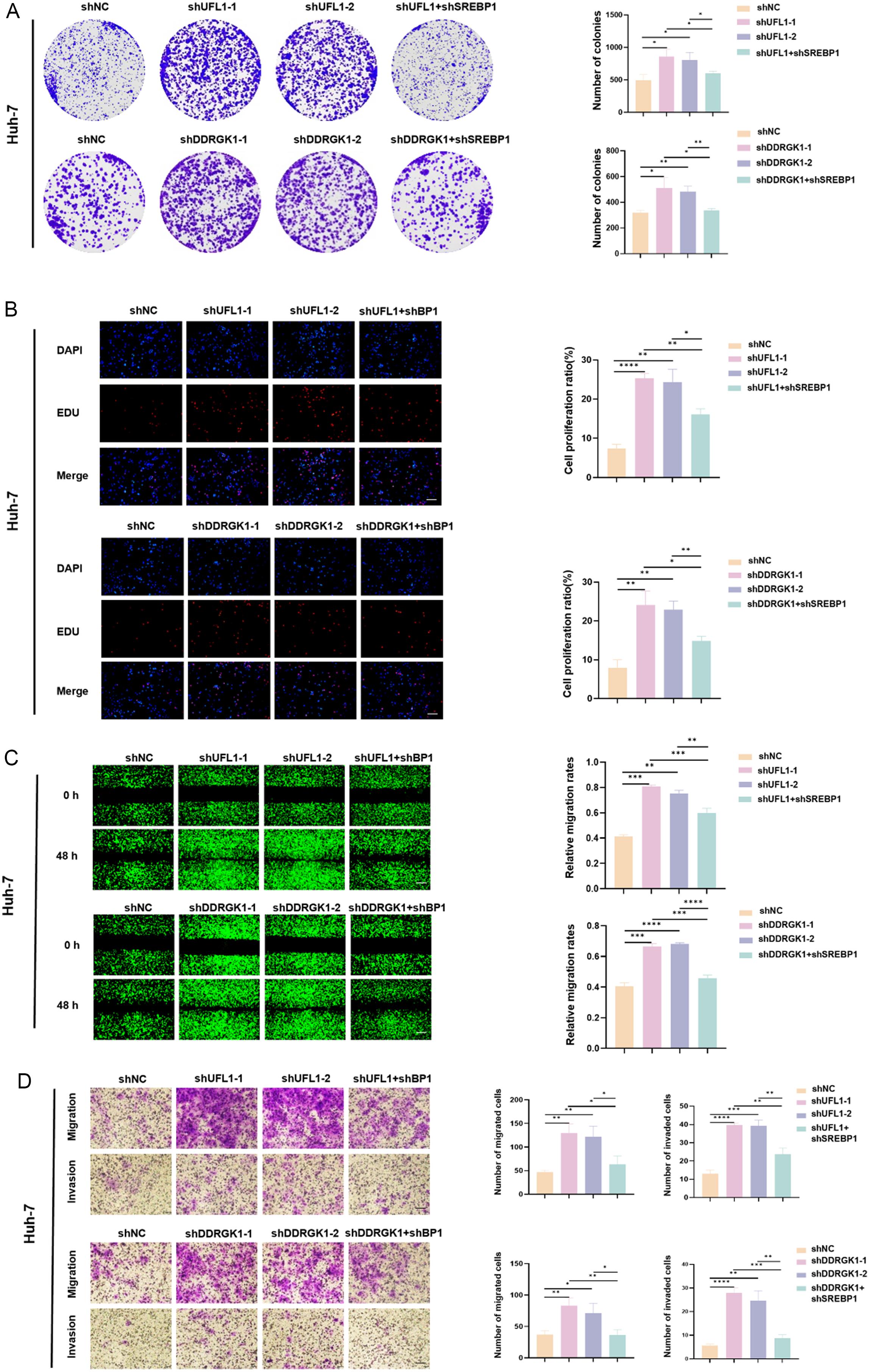 The effects of UFL1 or DDRGK1 knockdown on the <italic>in vitro</italic> growth and metastasis of HCC.