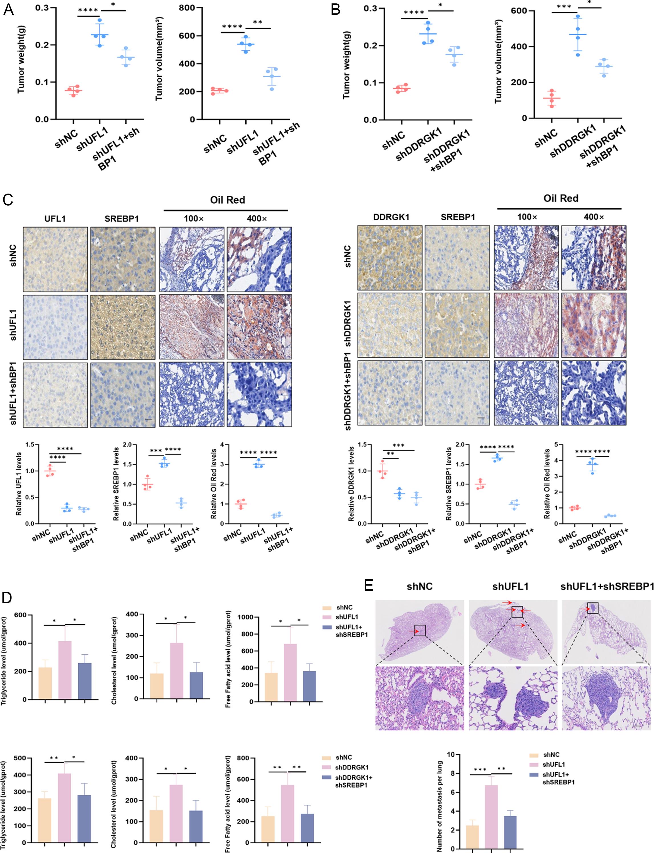 The effects of UFL1 or DDRGK1 knockdown on HCC growth and metastasis <italic>in vivo</italic>.