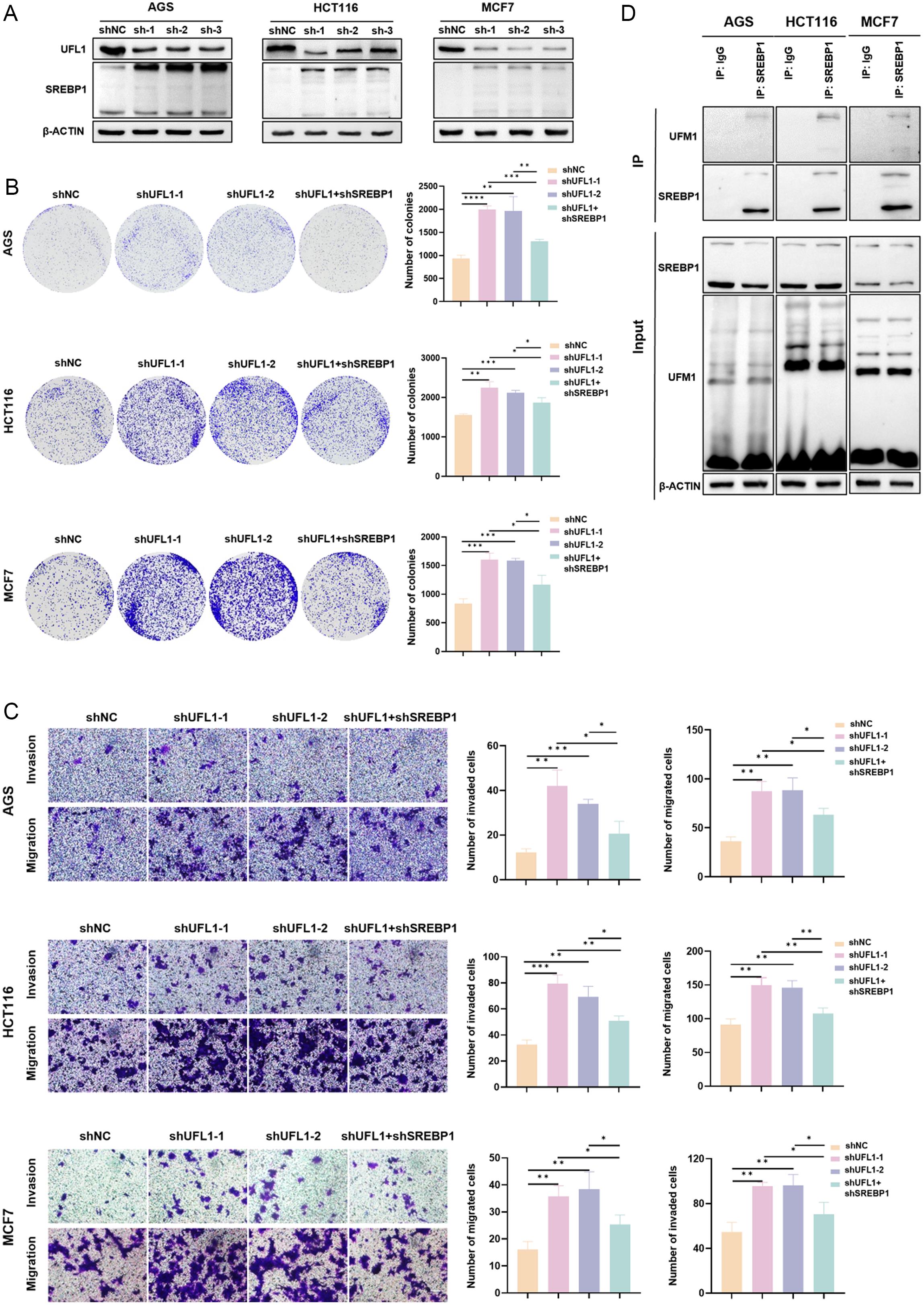 The effects of the combination of SREBP1 inhibitor with lenvatinib in HCC.
