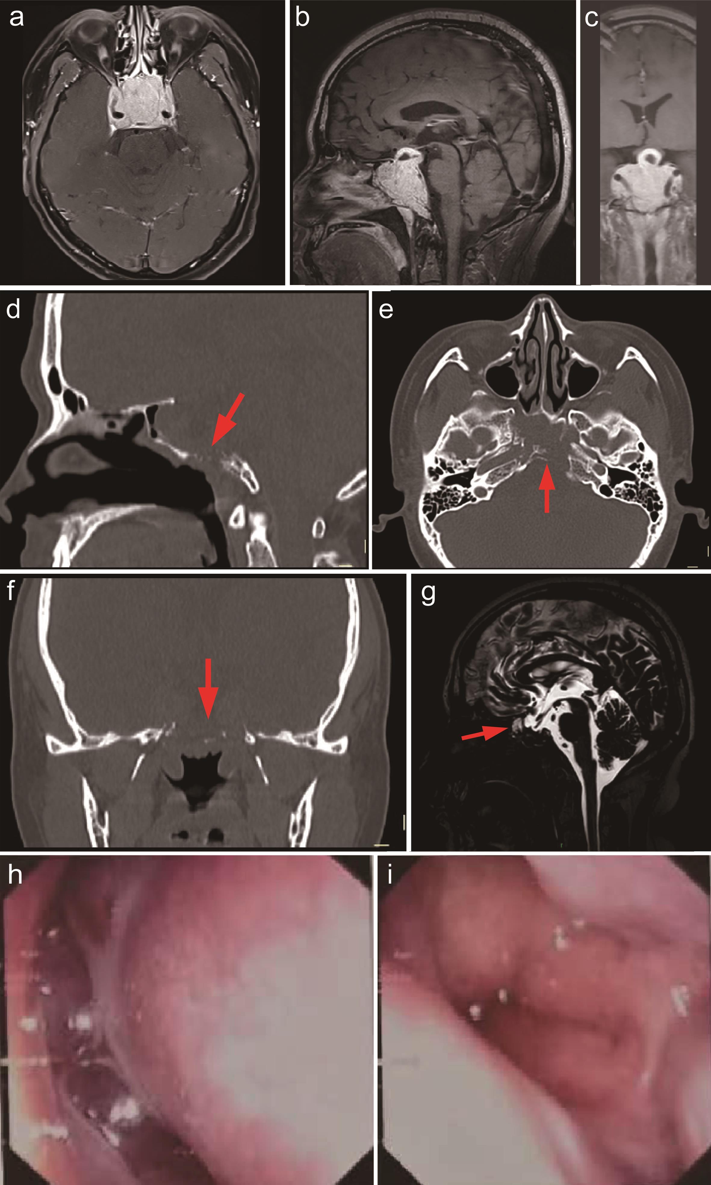 Preoperative imaging and endoscopic findings.