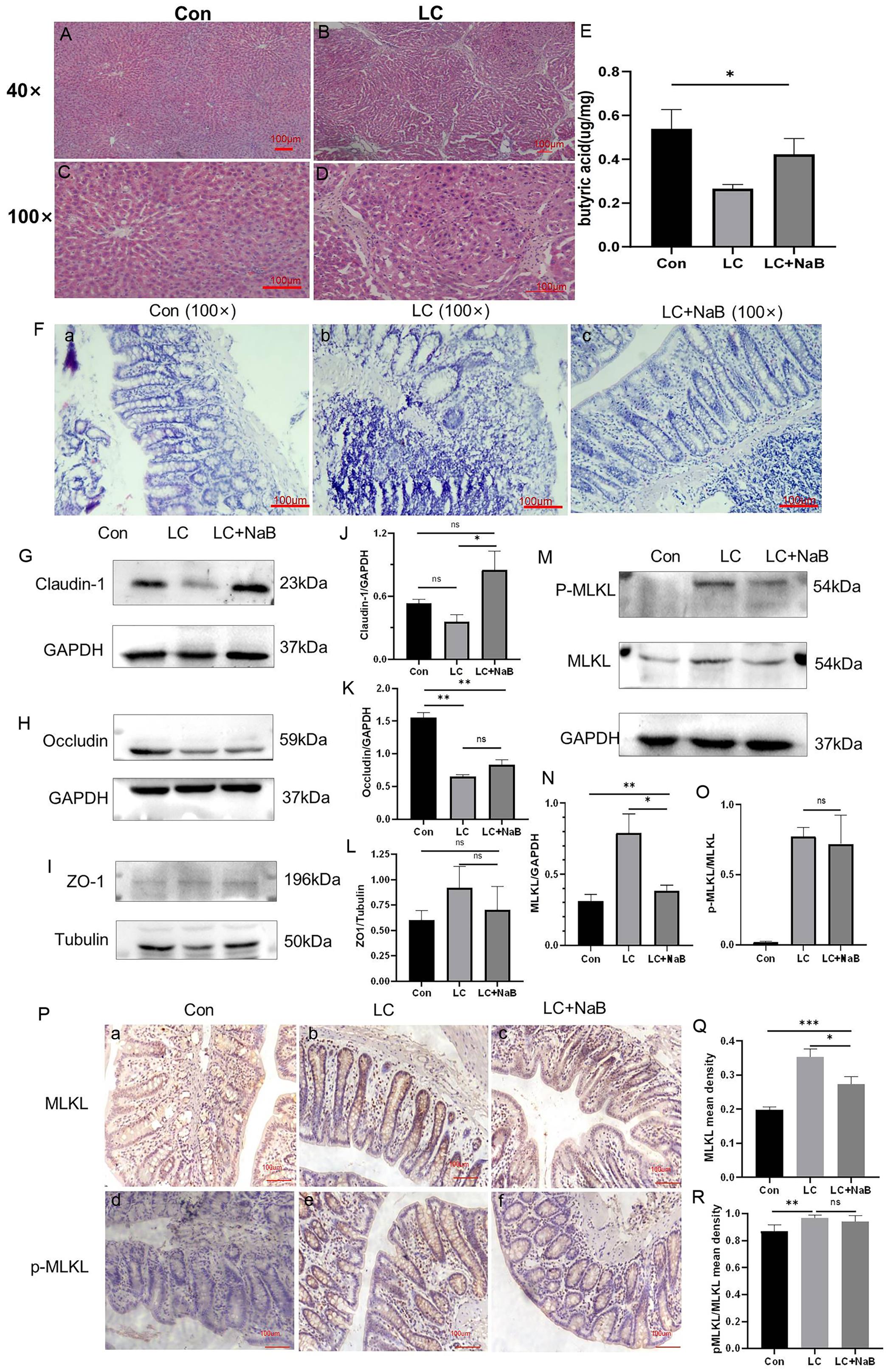 The effects of NaB on necroptosis in the IECs of cirrhotic rats.