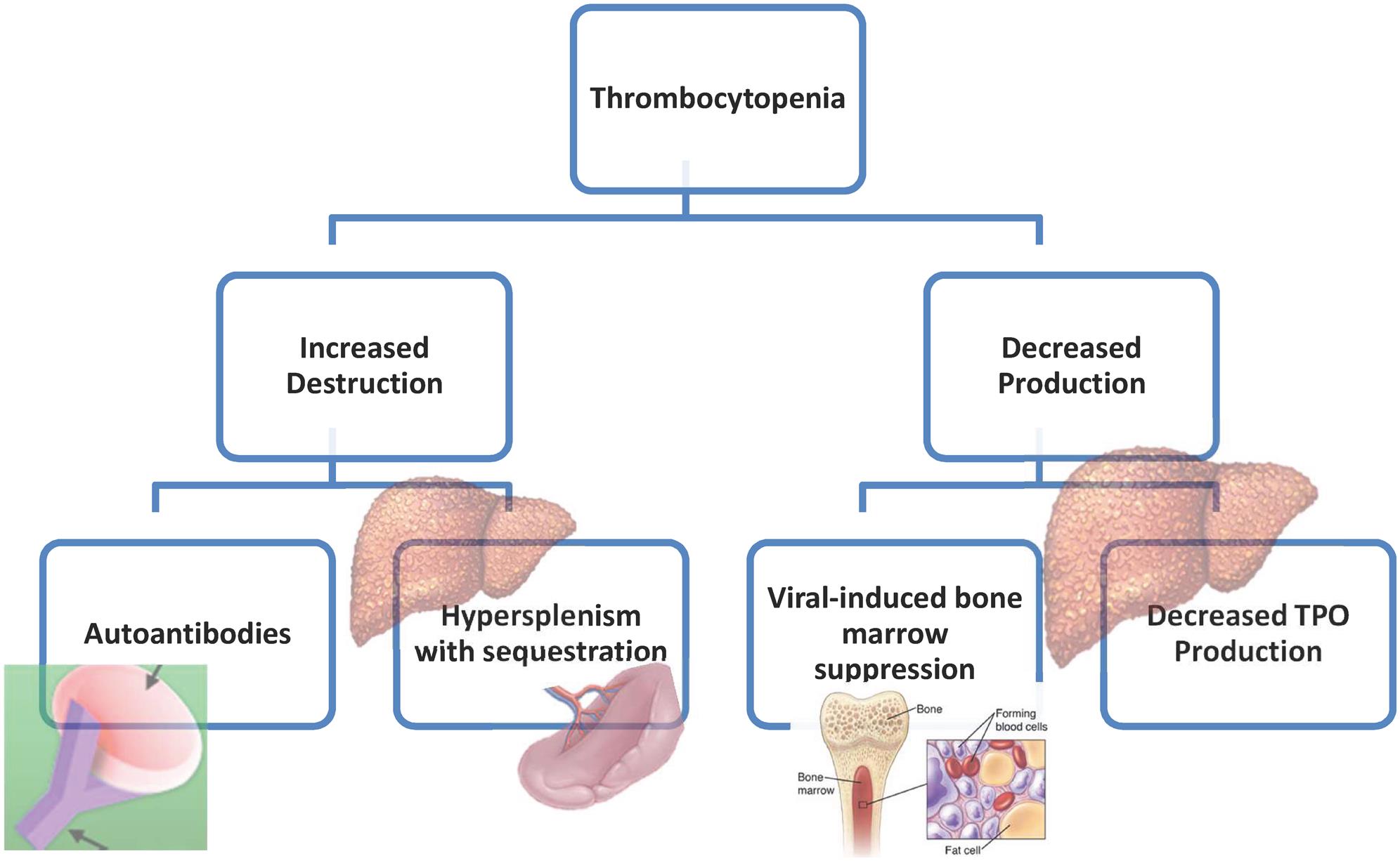 Pathophysiologic mechanisms of thrombocytopenia.