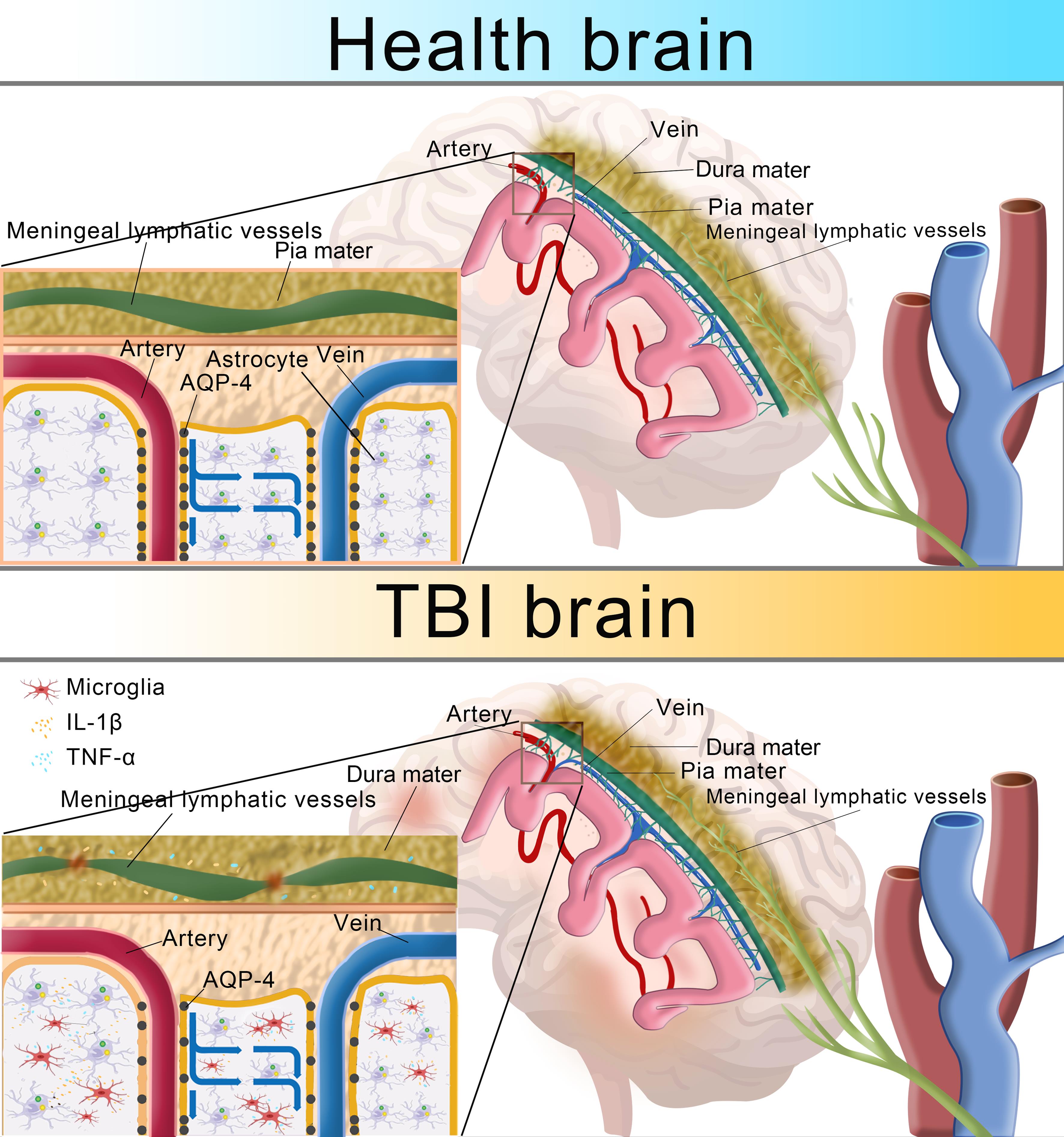 In the healthy brain, the glymphatic system is composed of ISF, astrocytes, and meningeal lymphatic vessels.