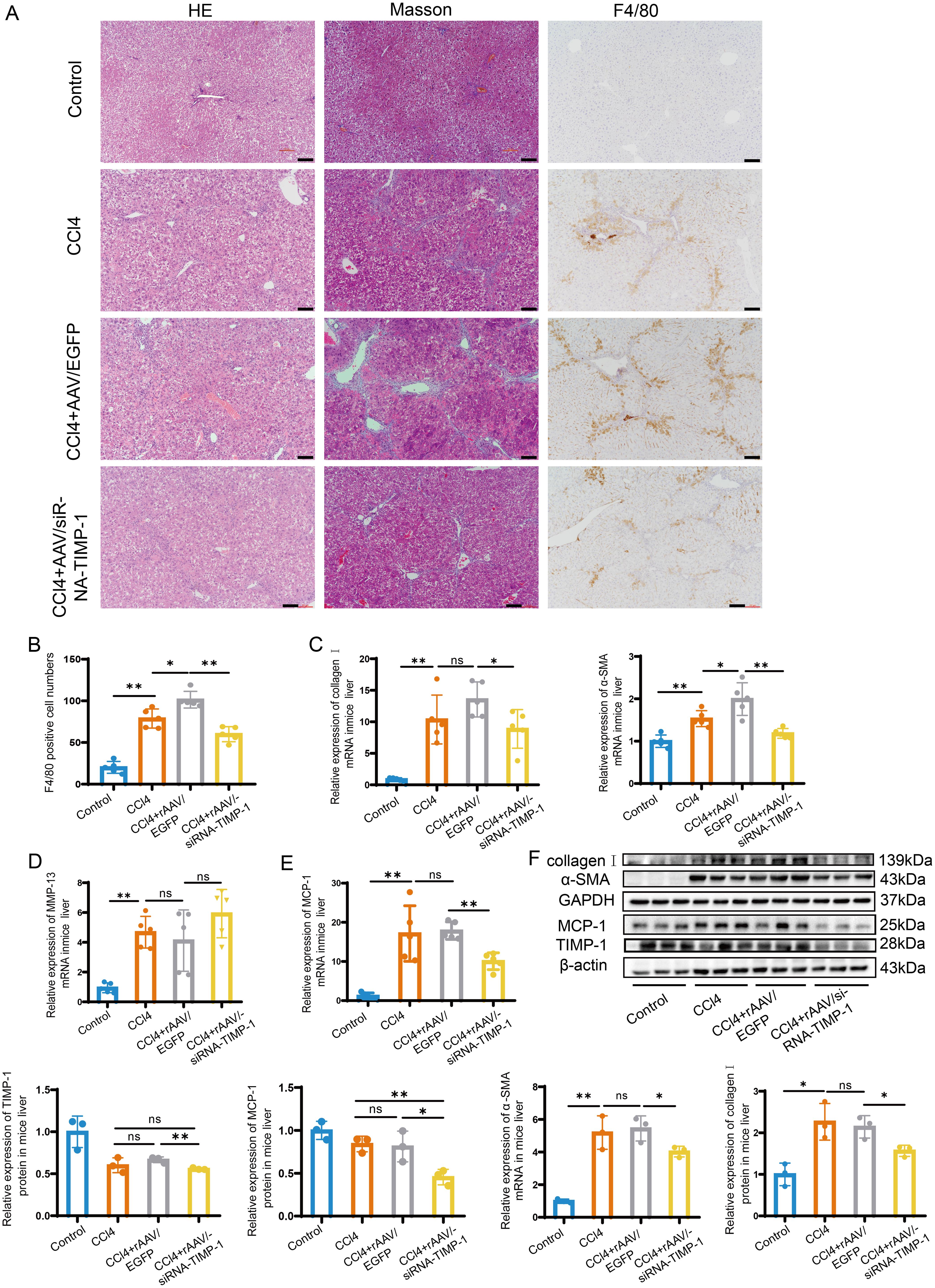 Silencing of TIMP-1 in CCl<sub>4</sub>-treated mice attenuates liver fibrosis and macrophage recruitment.