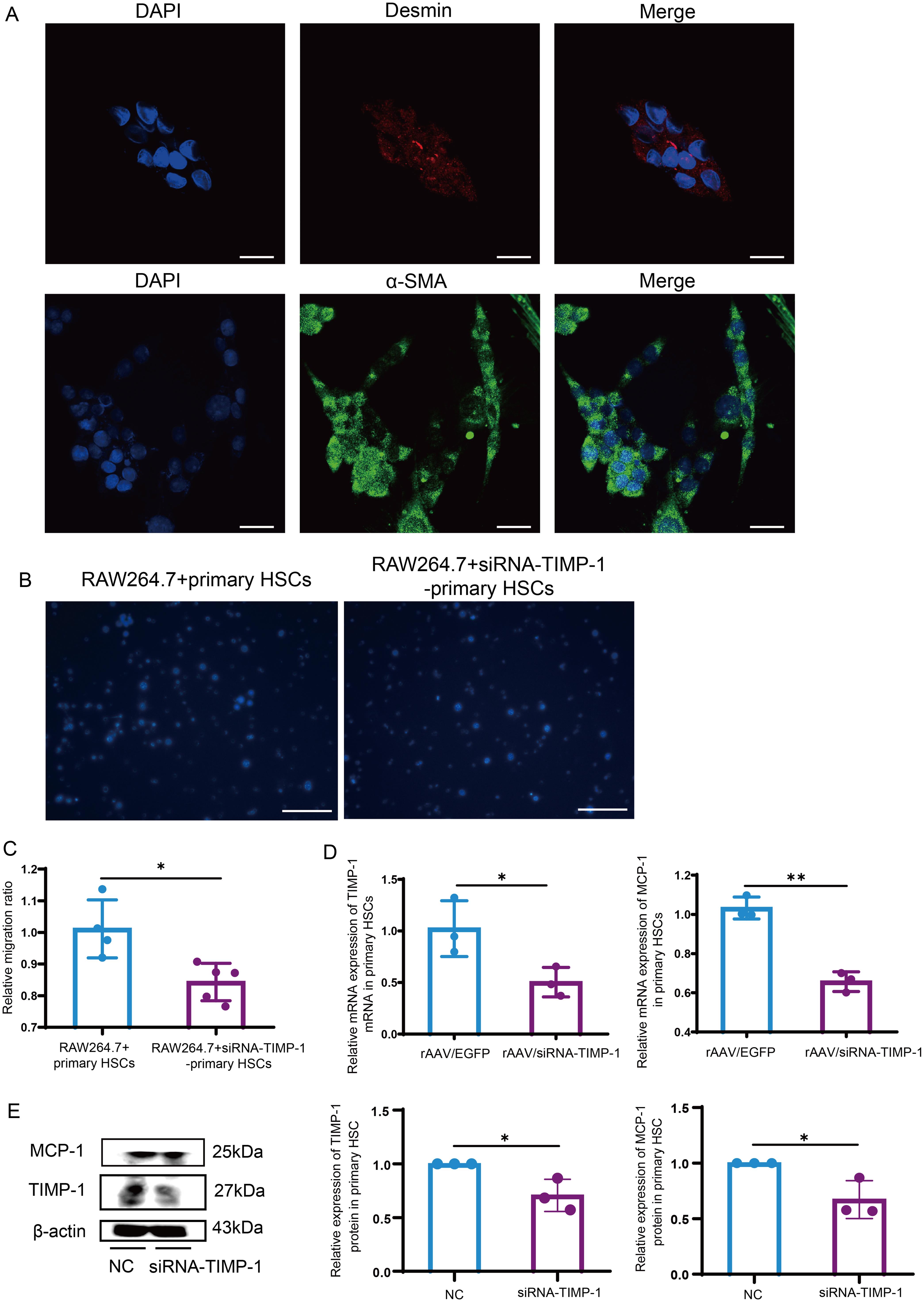 Downregulation of TIMP-1 in primary HSCs from mice suppresses the macrophage migration and inhibits MCP-1 expression.