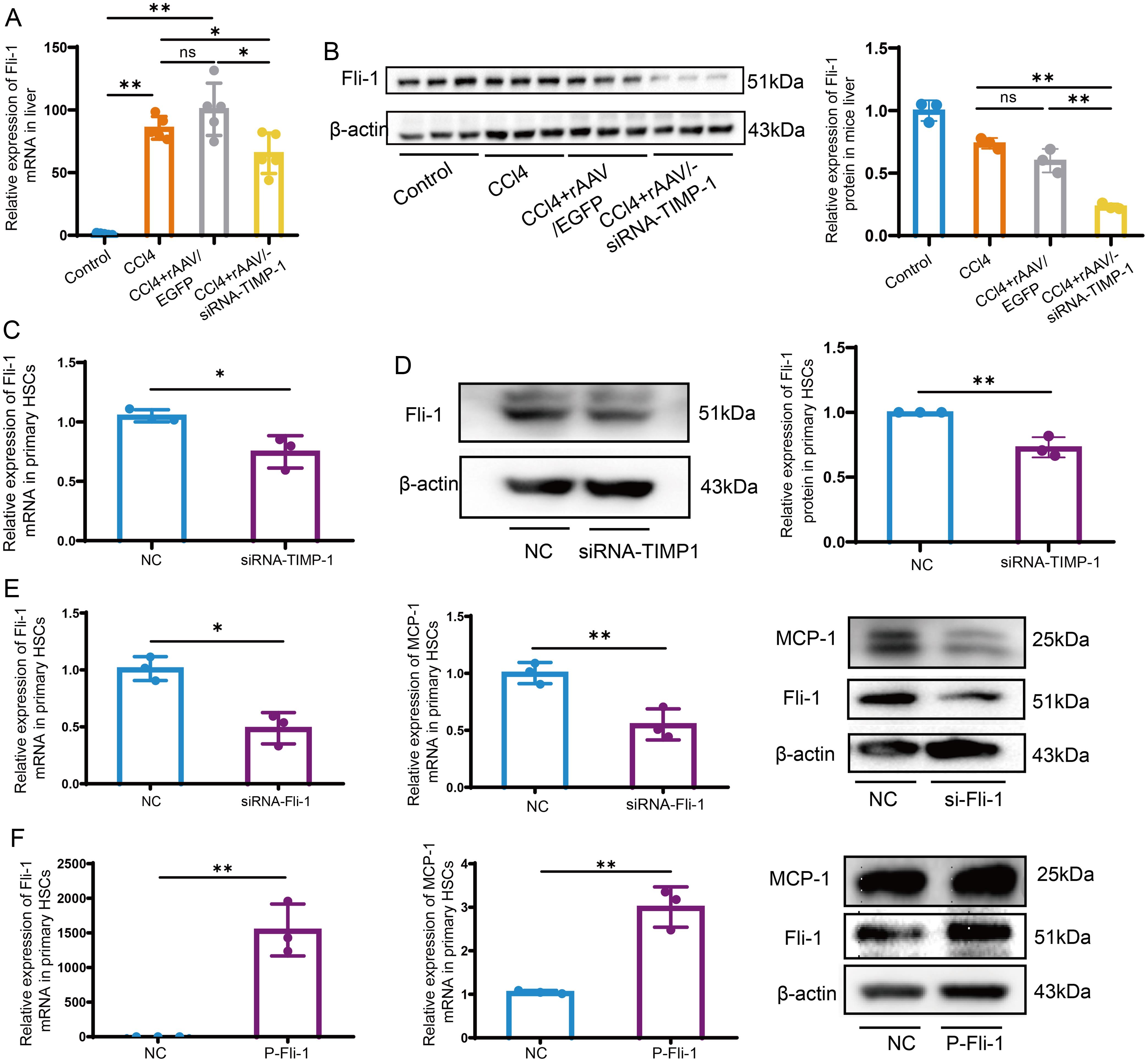 TIMP-1 regulates the expression of MCP-1 via Fli-1 in mice and primary HSCs.