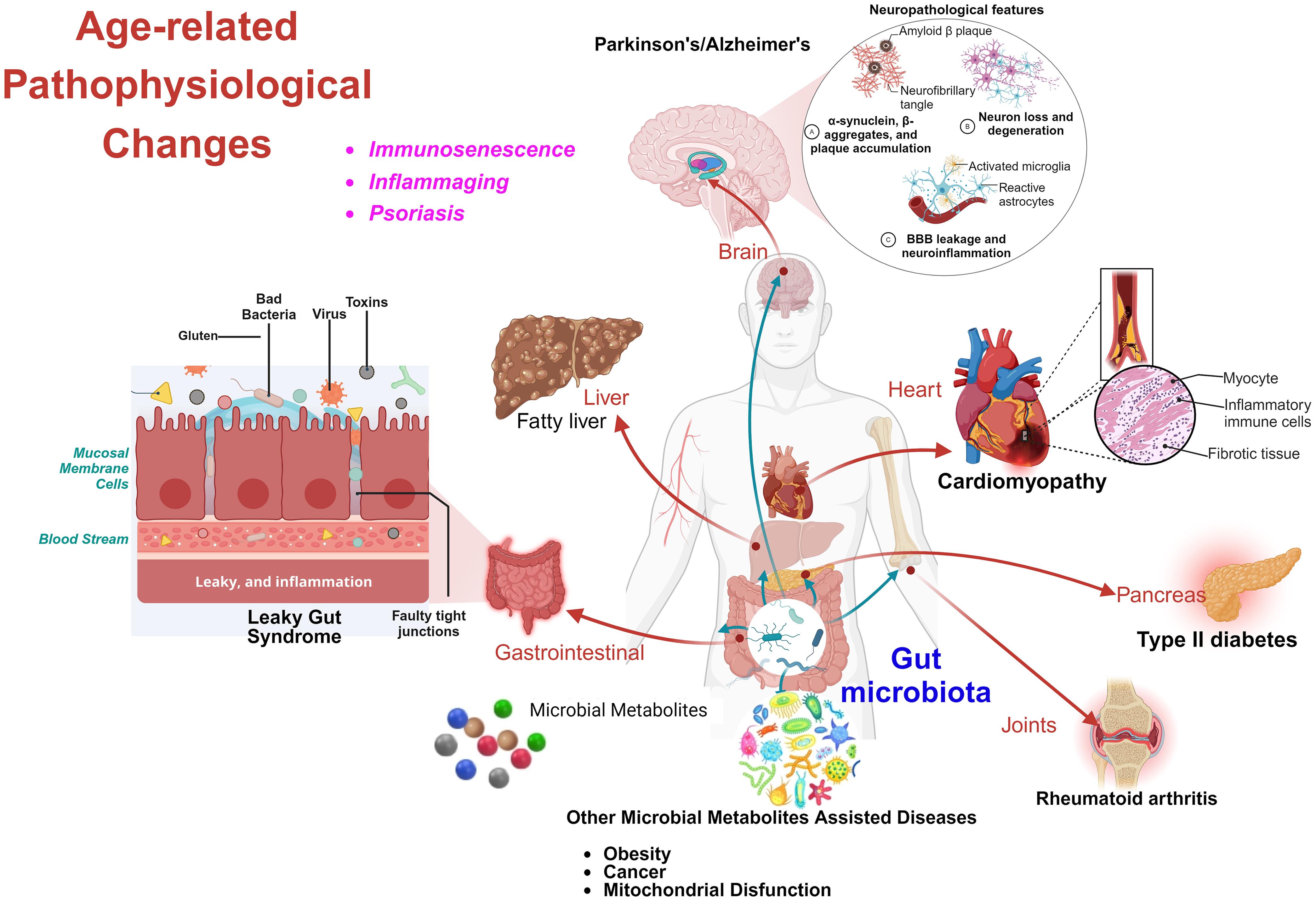 Summary of age-related pathophysiological changes in host associated with gut microbiome.