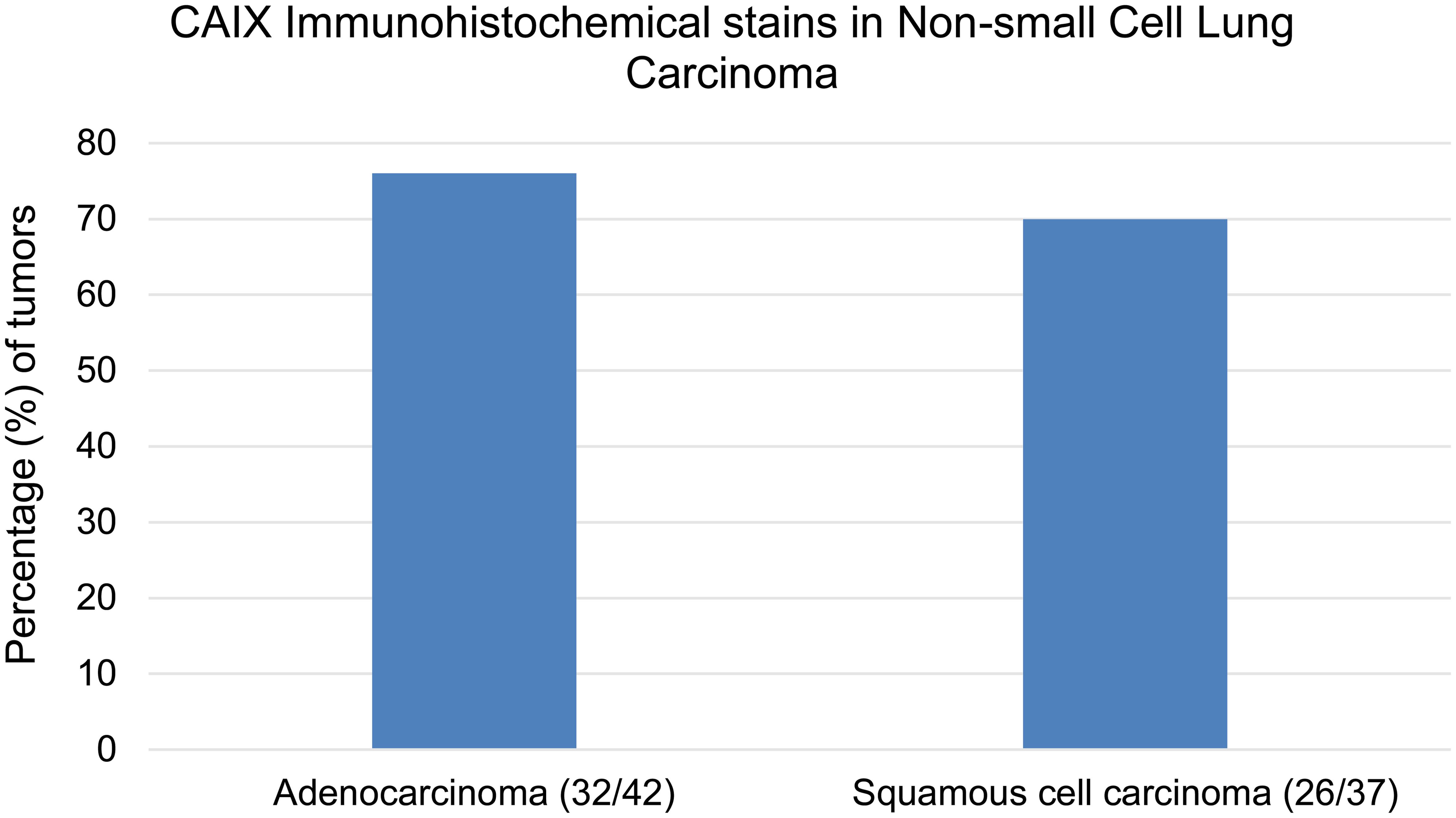 The specificity of CAIX immunostaining on TMA of non-small cell lung carcinoma.